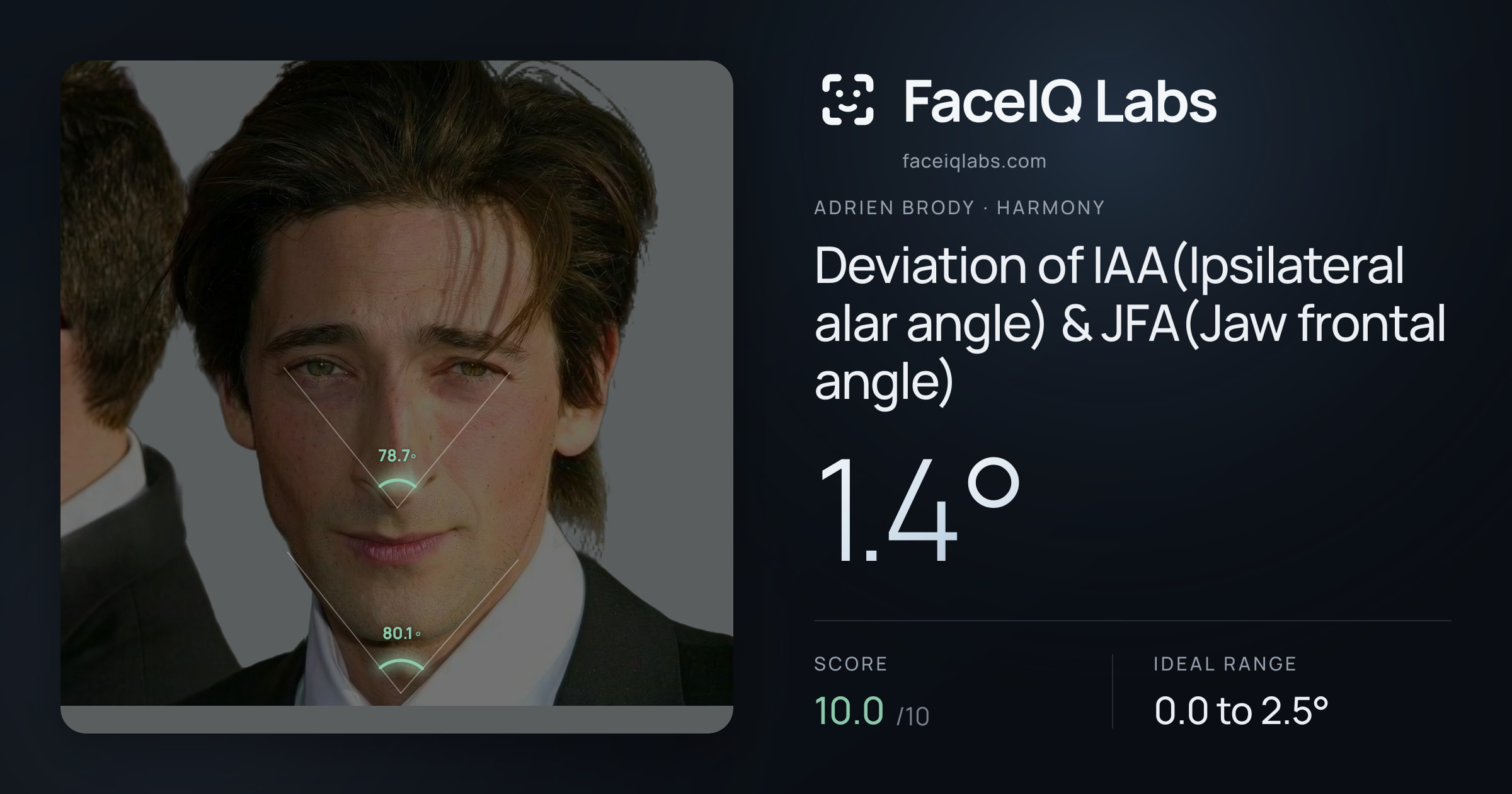 Adrien Brody Deviation of IAA(Ipsilateral alar angle) & JFA(Jaw frontal angle): 1.4°, drawn on the photo