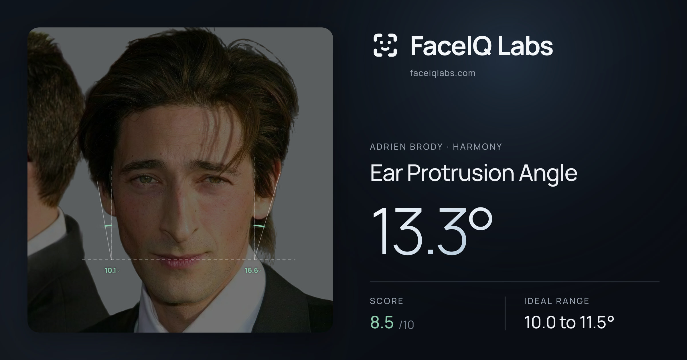 Adrien Brody Ear Protrusion Angle: 13.3°, drawn on the photo