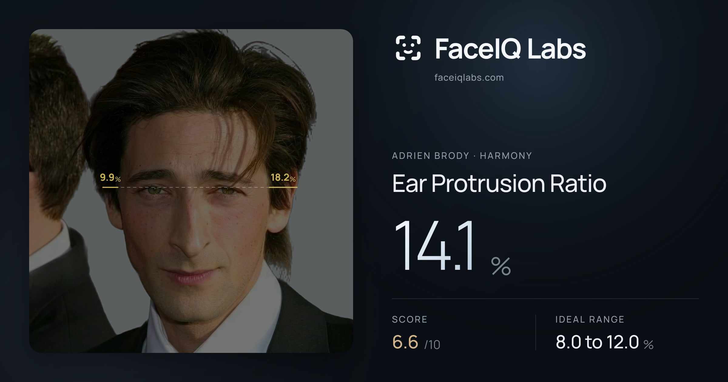 Adrien Brody Ear Protrusion Ratio: 14.1%, drawn on the photo