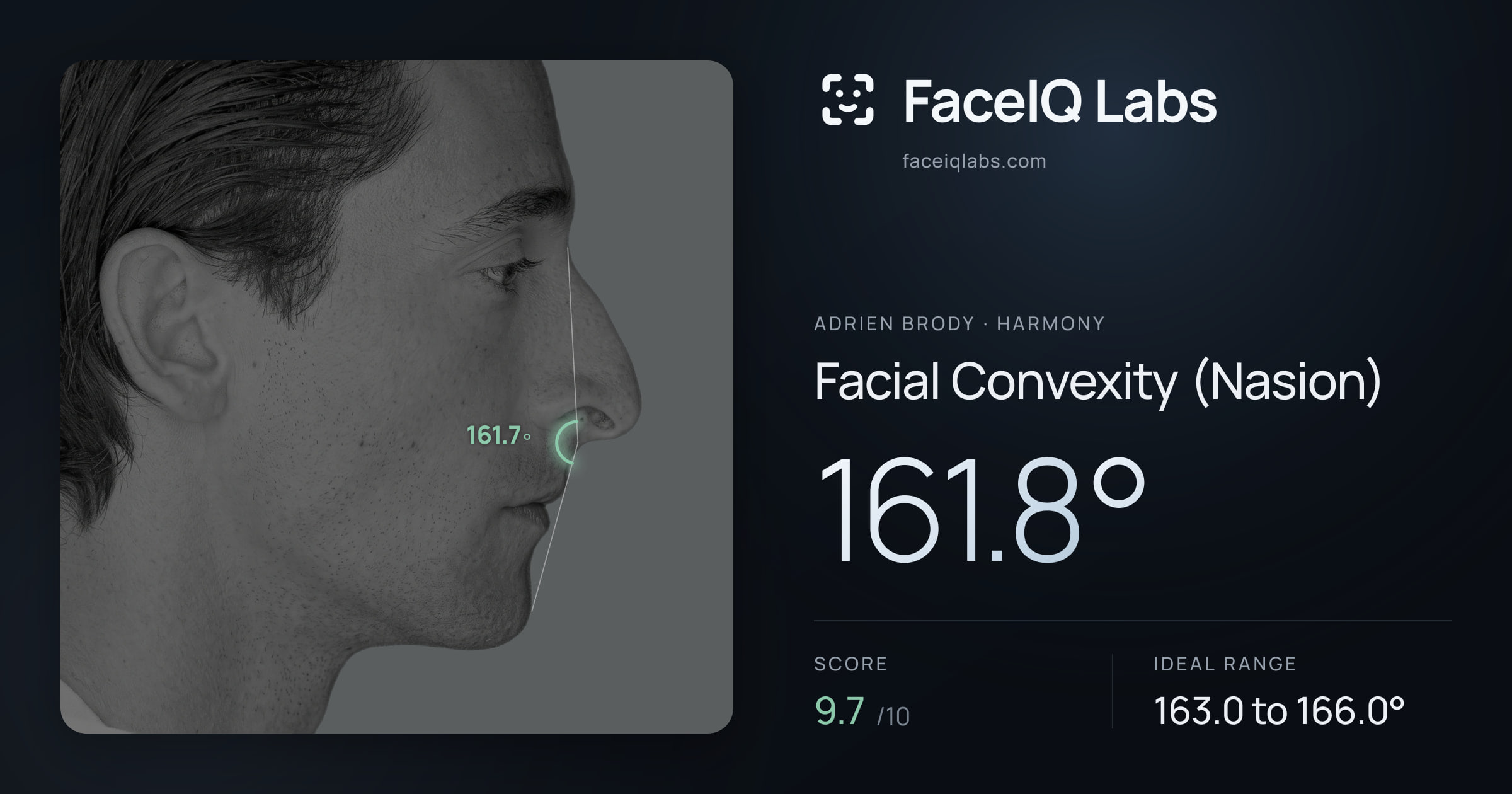 Adrien Brody Facial Convexity (Nasion): 161.8°, drawn on the photo