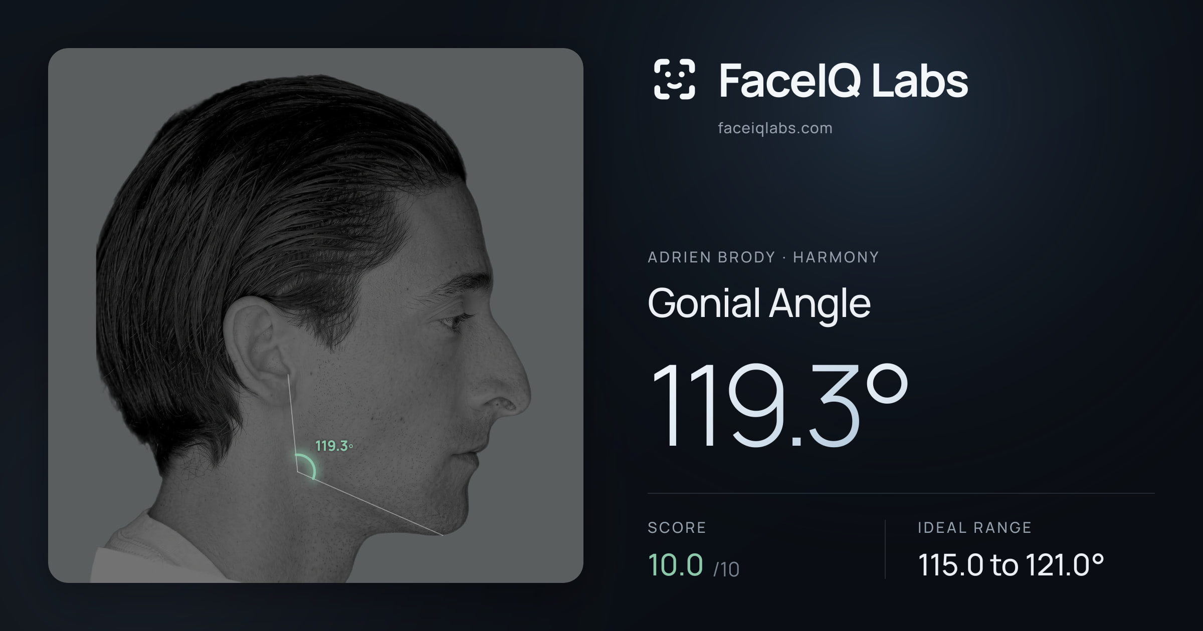 Adrien Brody Gonial Angle: 119.3°, drawn on the photo