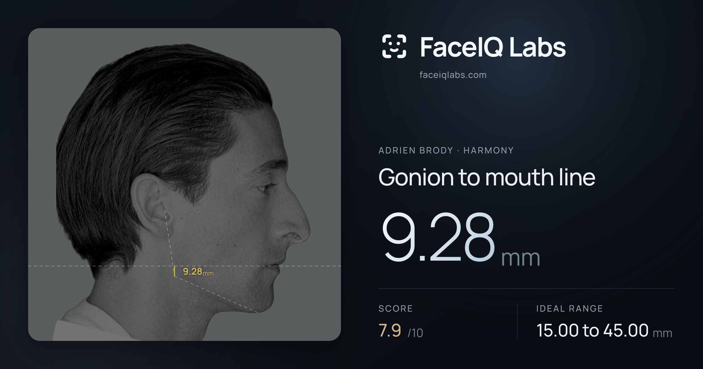 Adrien Brody Gonion to mouth line: 9.28mm, drawn on the photo