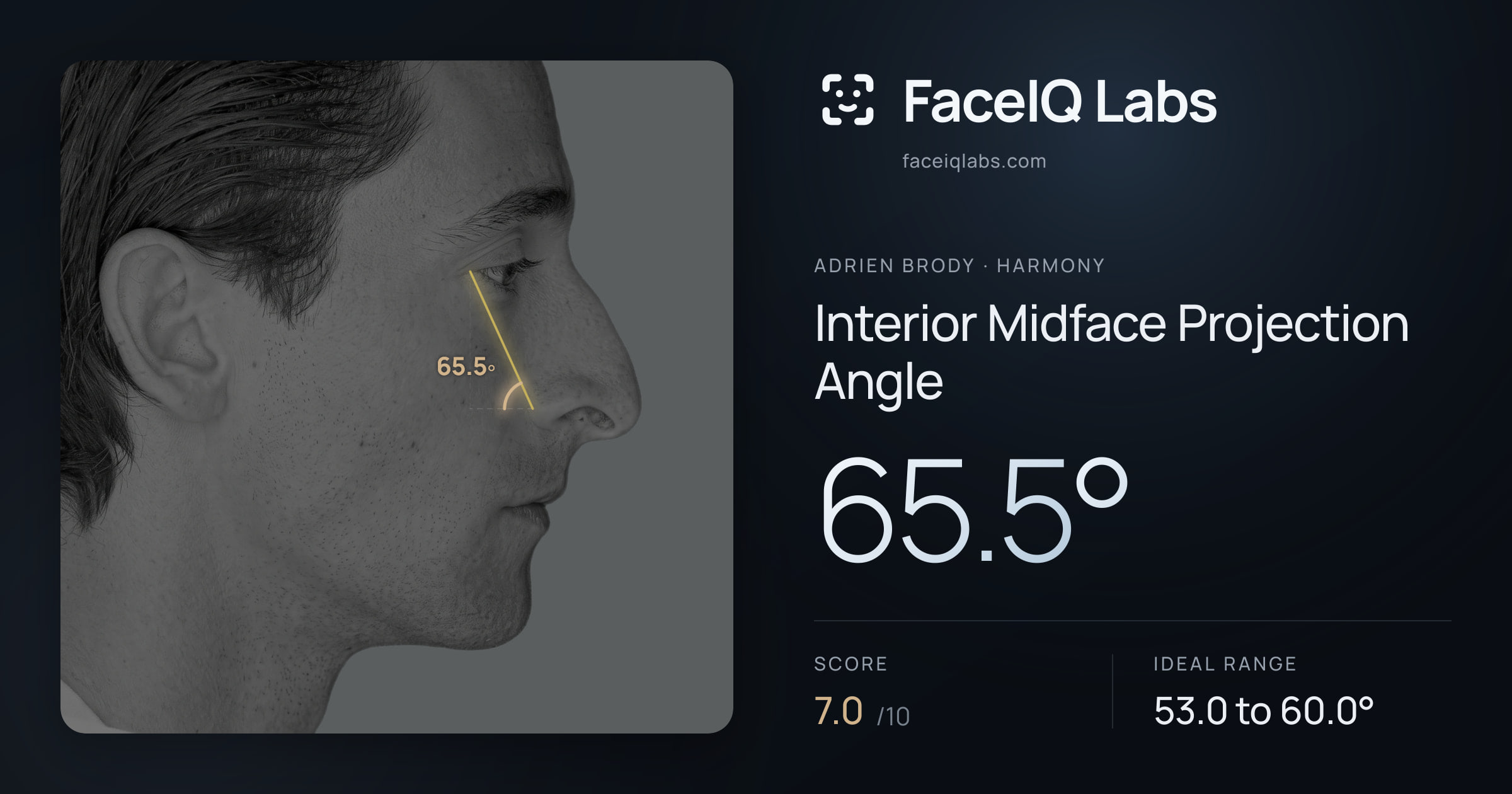 Adrien Brody Interior Midface Projection Angle: 65.5°, drawn on the photo