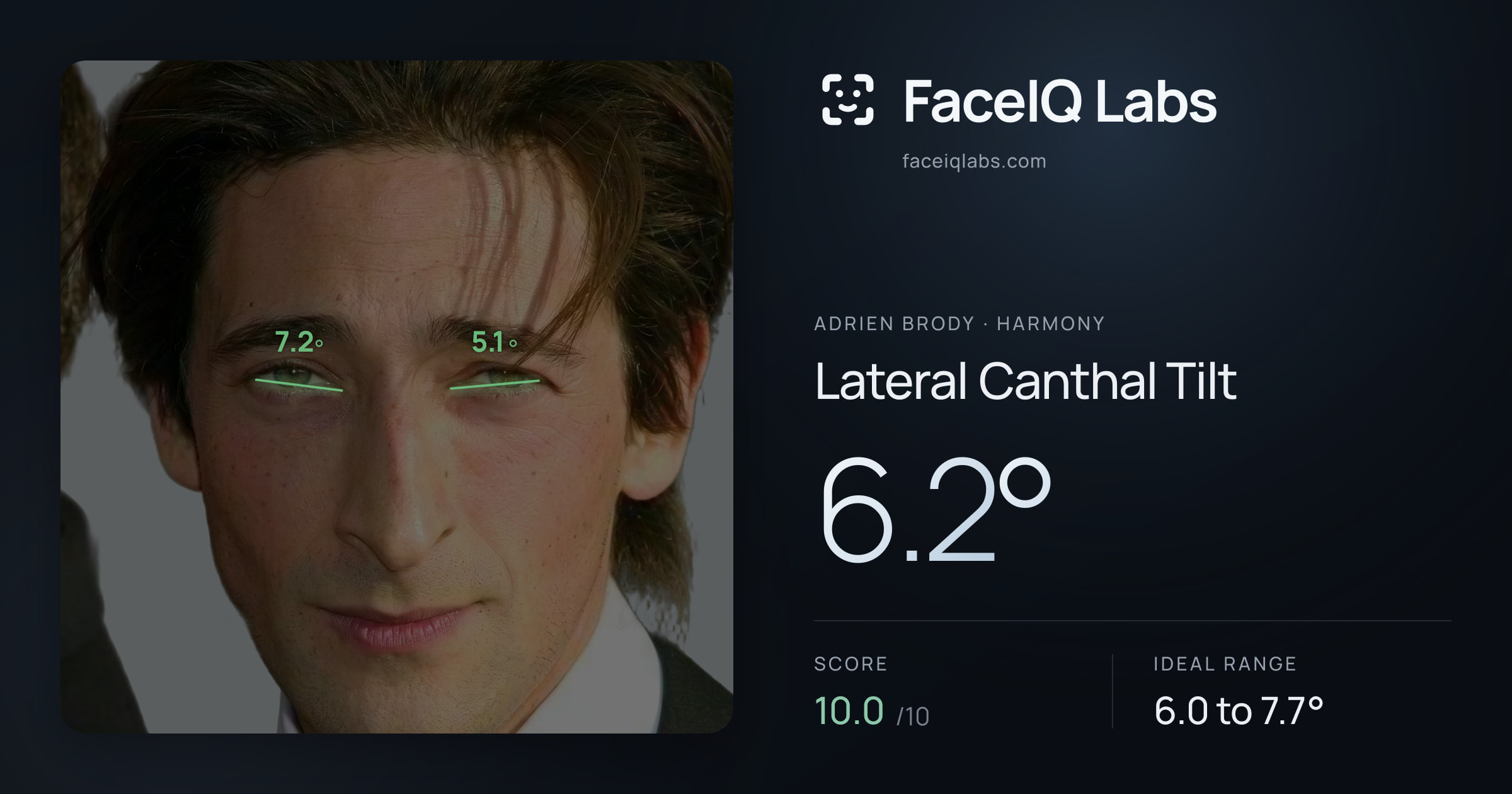 Adrien Brody Lateral Canthal Tilt: 6.2°, drawn on the photo