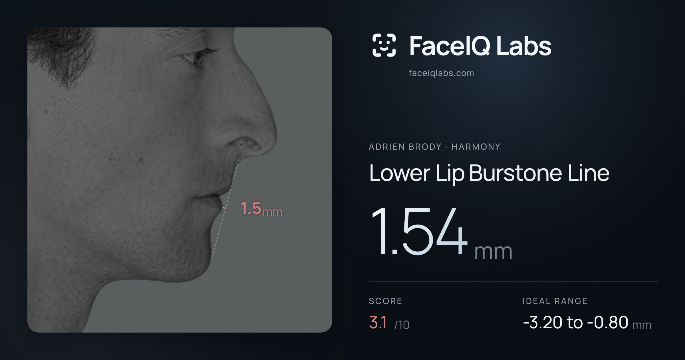 Adrien Brody Lower Lip Burstone Line: 1.54mm, drawn on the photo