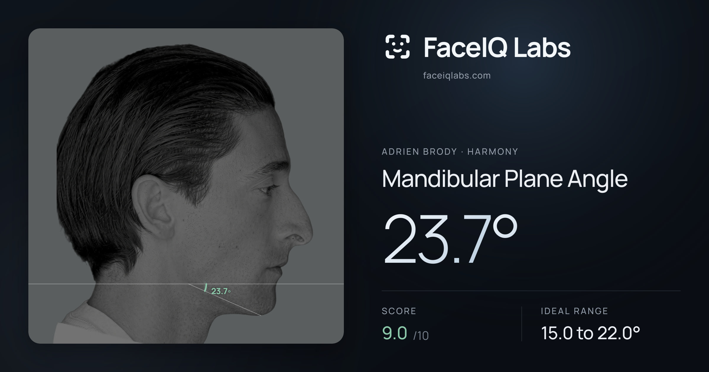 Adrien Brody Mandibular Plane Angle: 23.7°, drawn on the photo