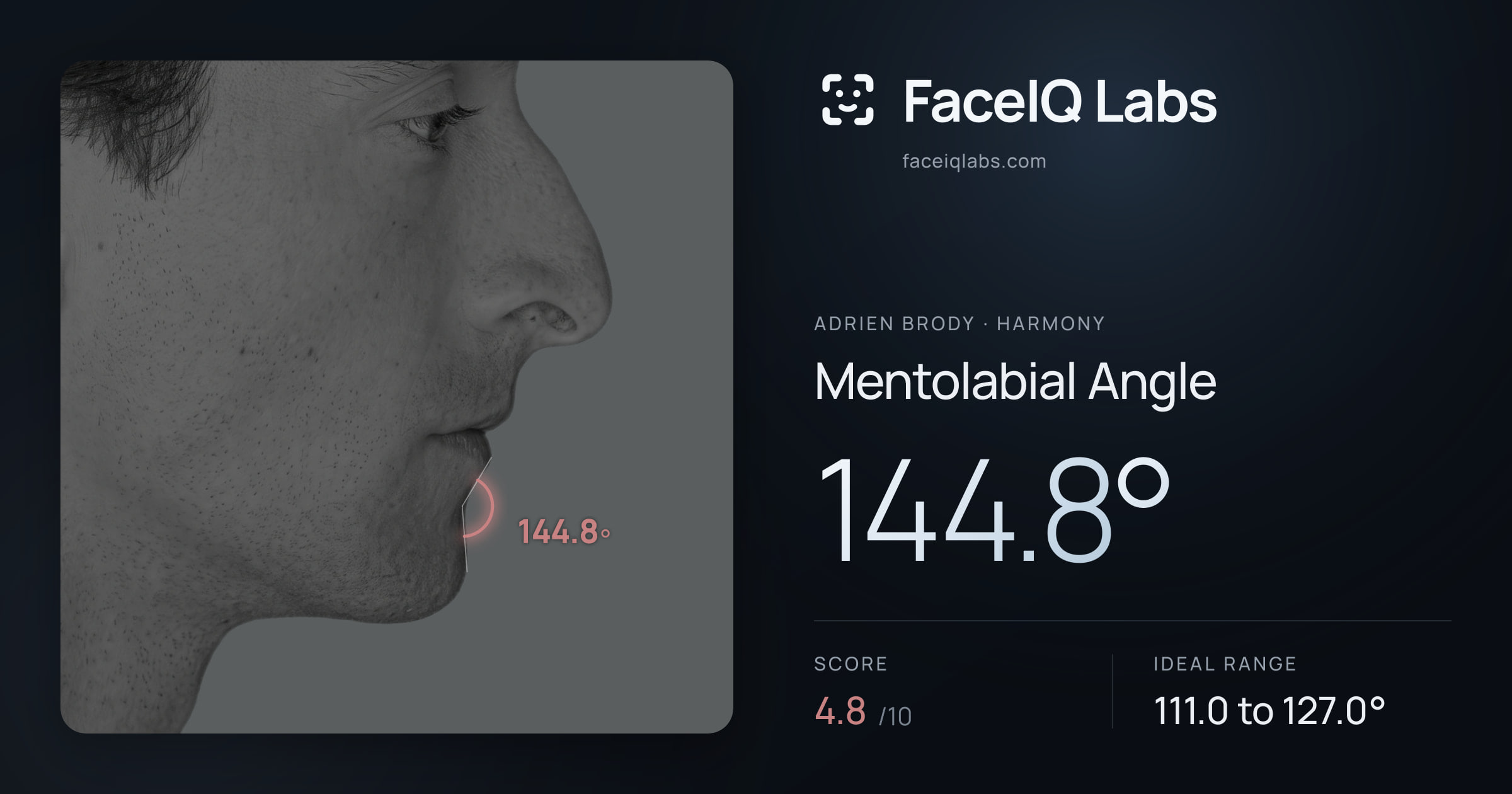 Adrien Brody Mentolabial Angle: 144.8°, drawn on the photo