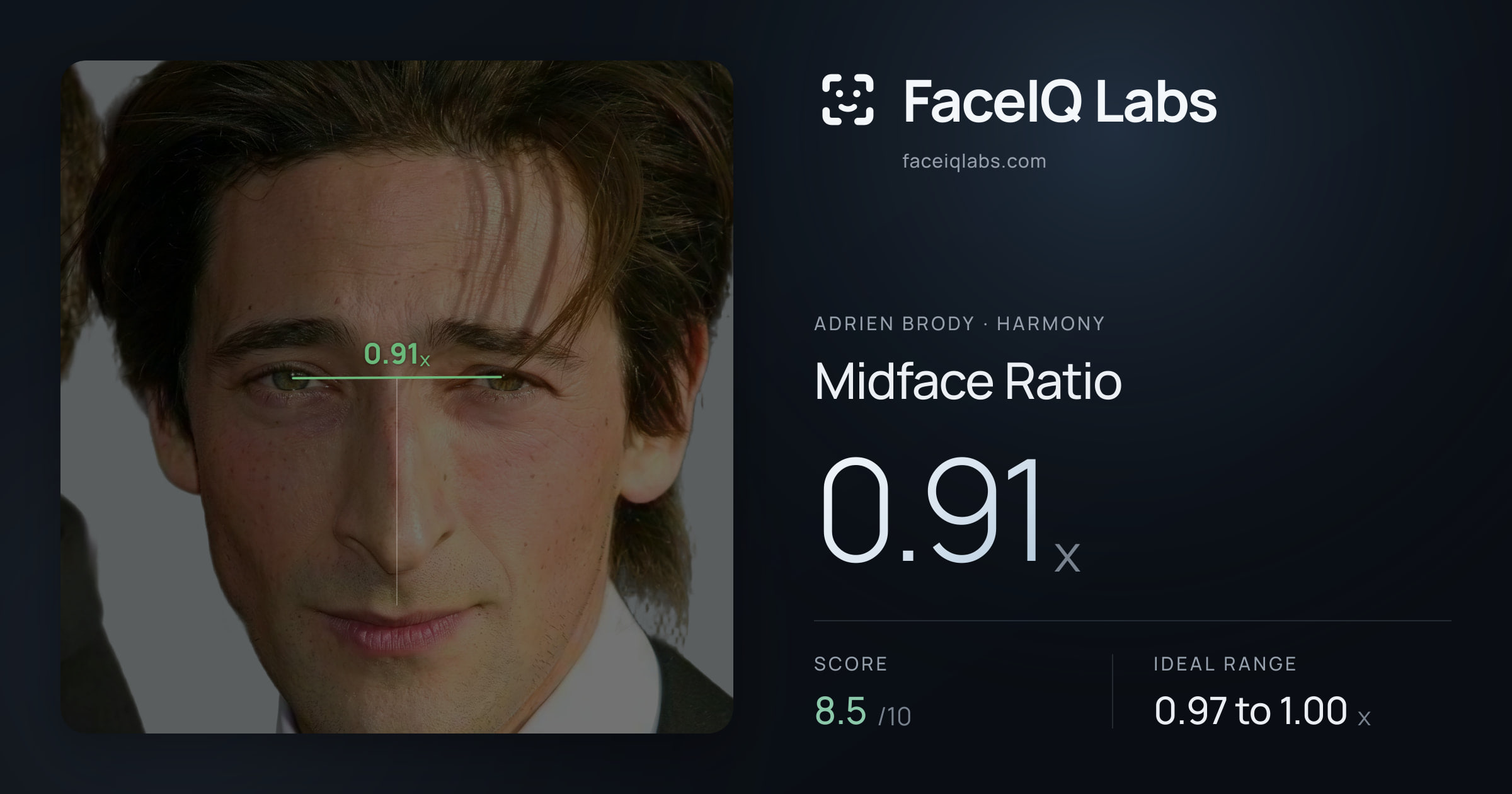 Adrien Brody Midface Ratio: 0.91x, drawn on the photo
