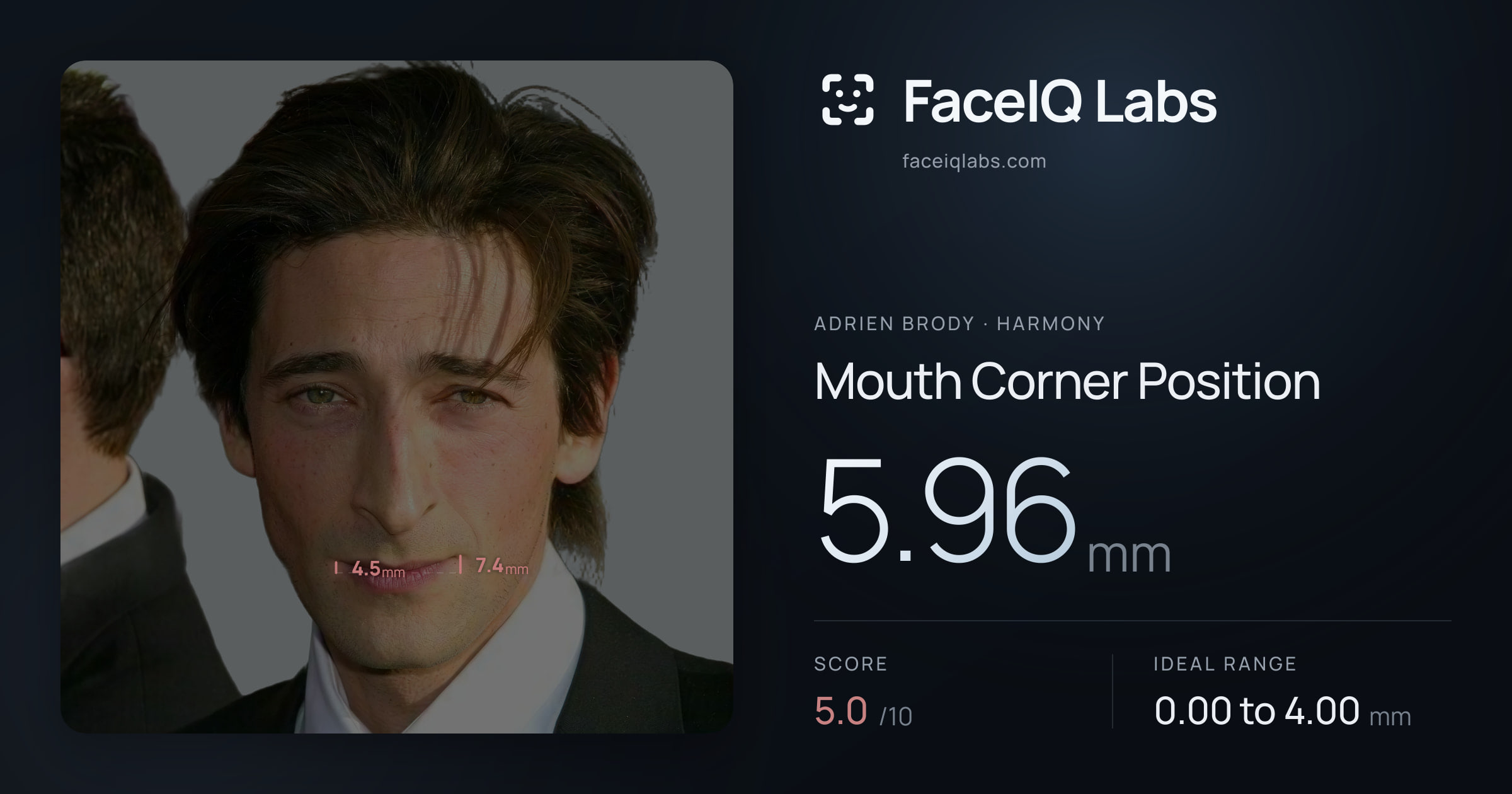 Adrien Brody Mouth Corner Position: 5.96mm, drawn on the photo