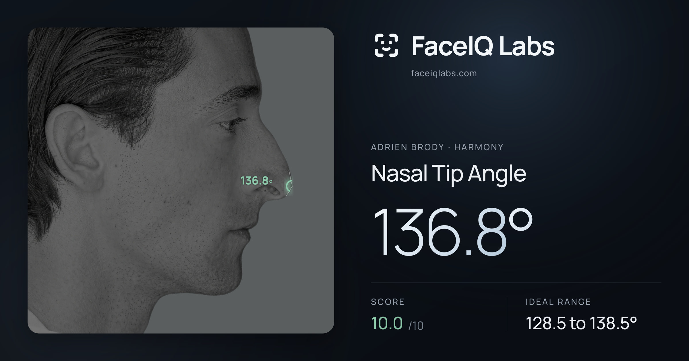 Adrien Brody Nasal Tip Angle: 136.8°, drawn on the photo