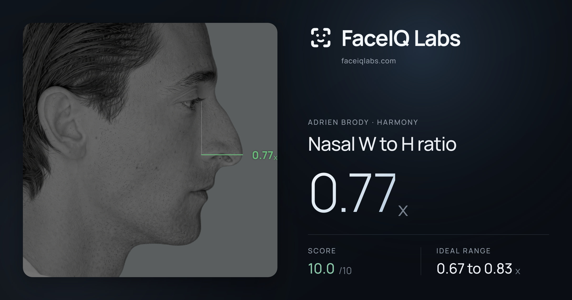 Adrien Brody Nasal W to H ratio: 0.77x, drawn on the photo