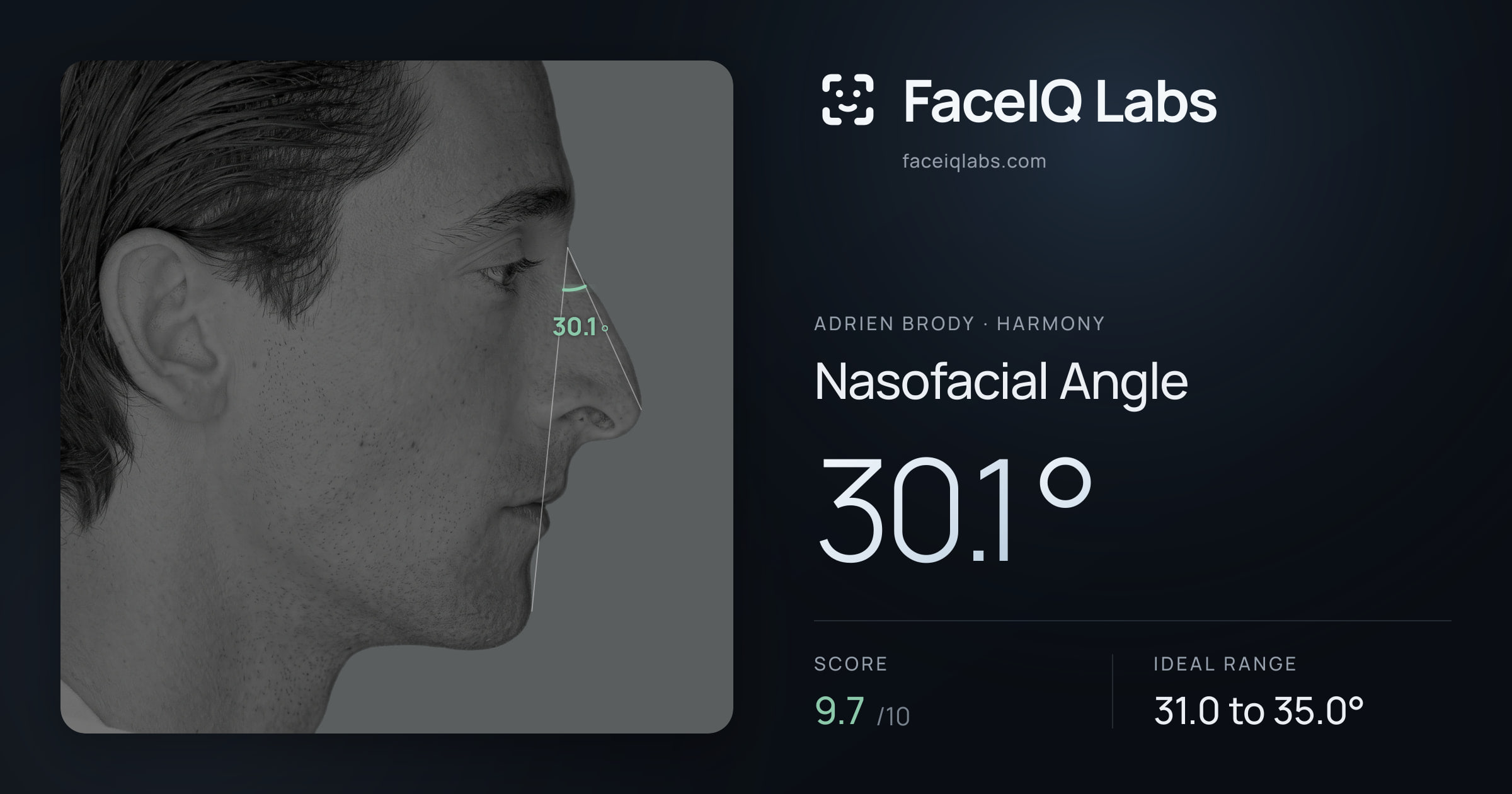Adrien Brody Nasofacial Angle: 30.1°, drawn on the photo