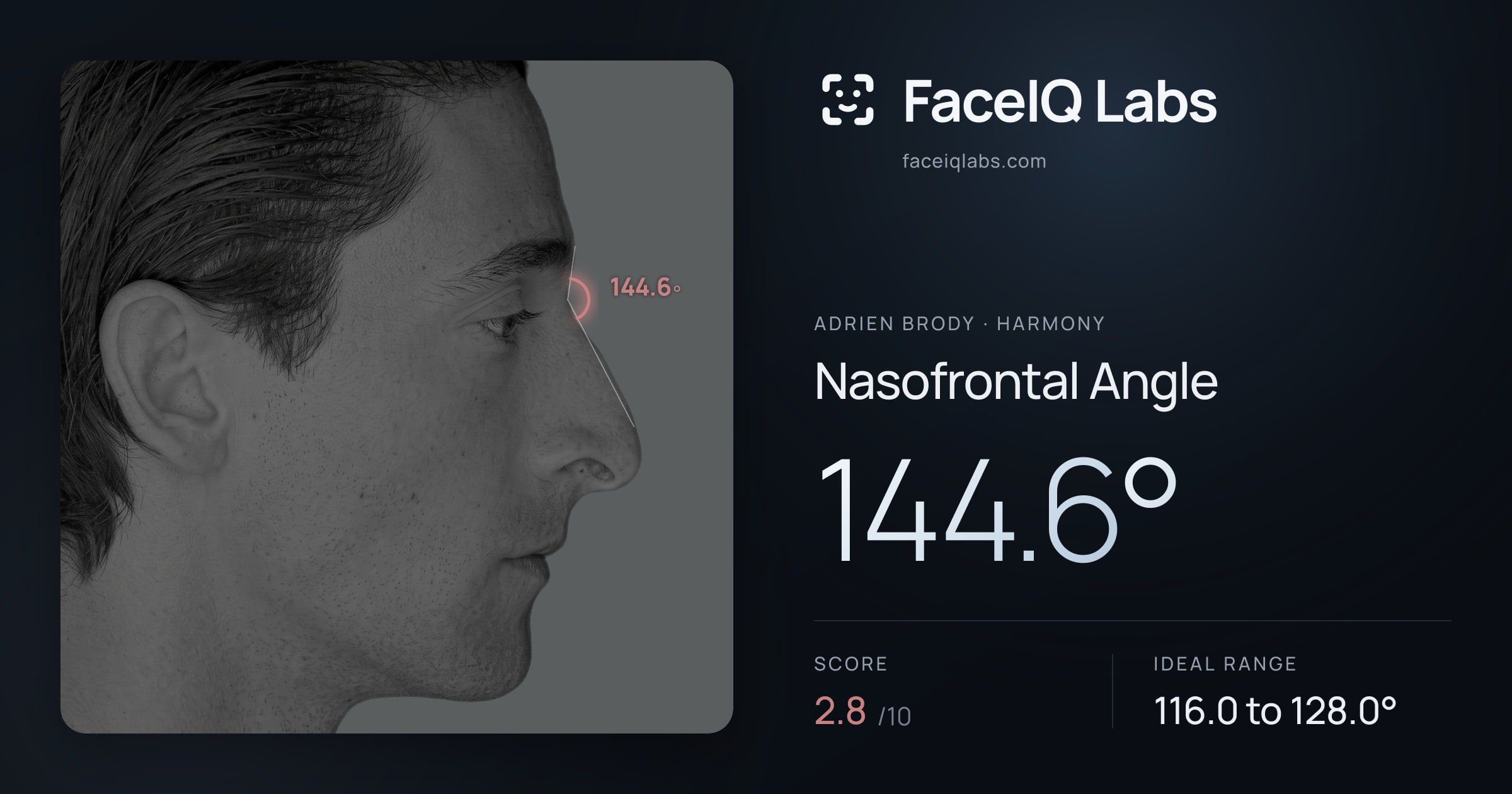 Adrien Brody Nasofrontal Angle: 144.6°, drawn on the photo