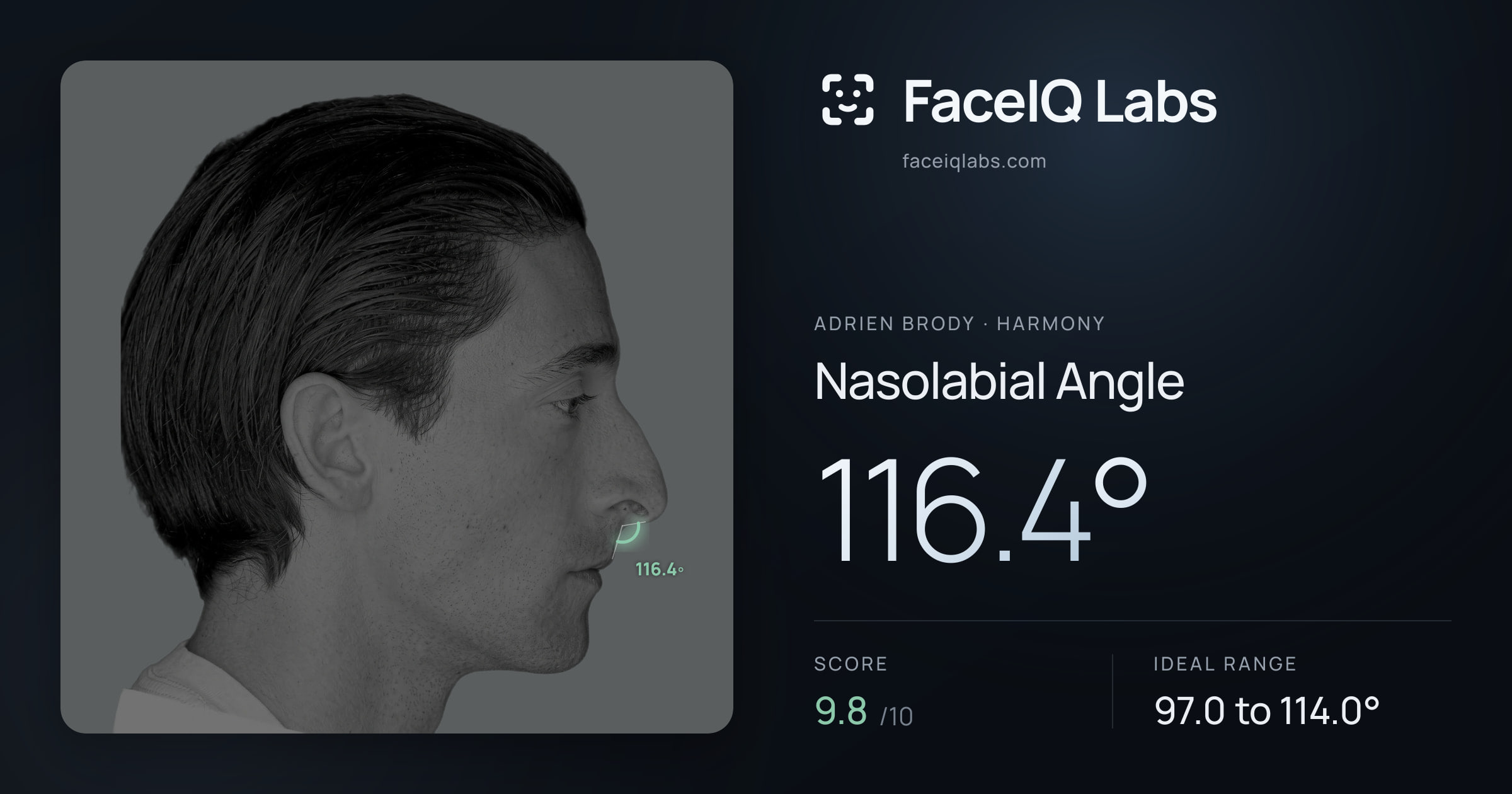 Adrien Brody Nasolabial Angle: 116.4°, drawn on the photo