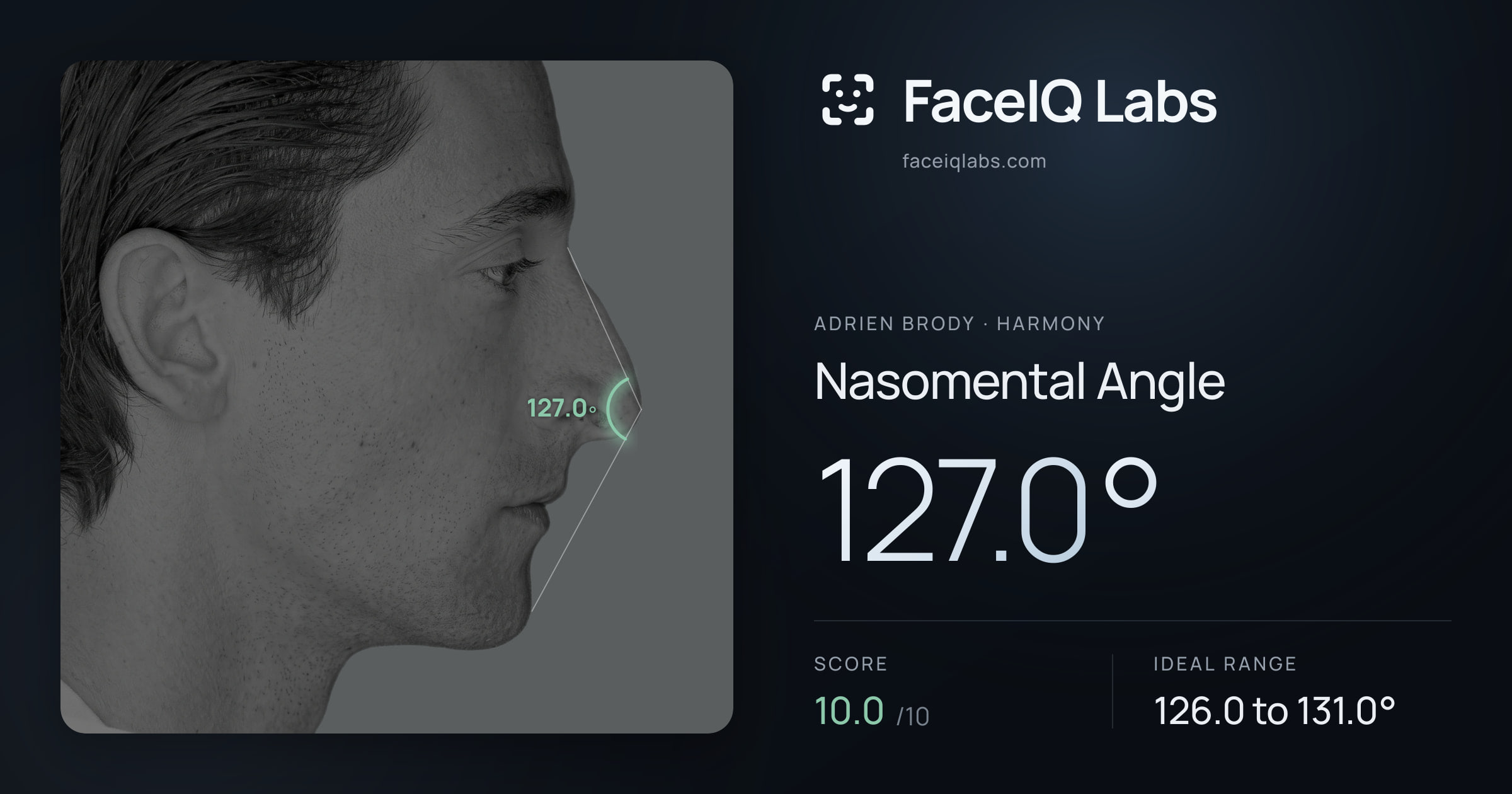 Adrien Brody Nasomental Angle: 127.0°, drawn on the photo