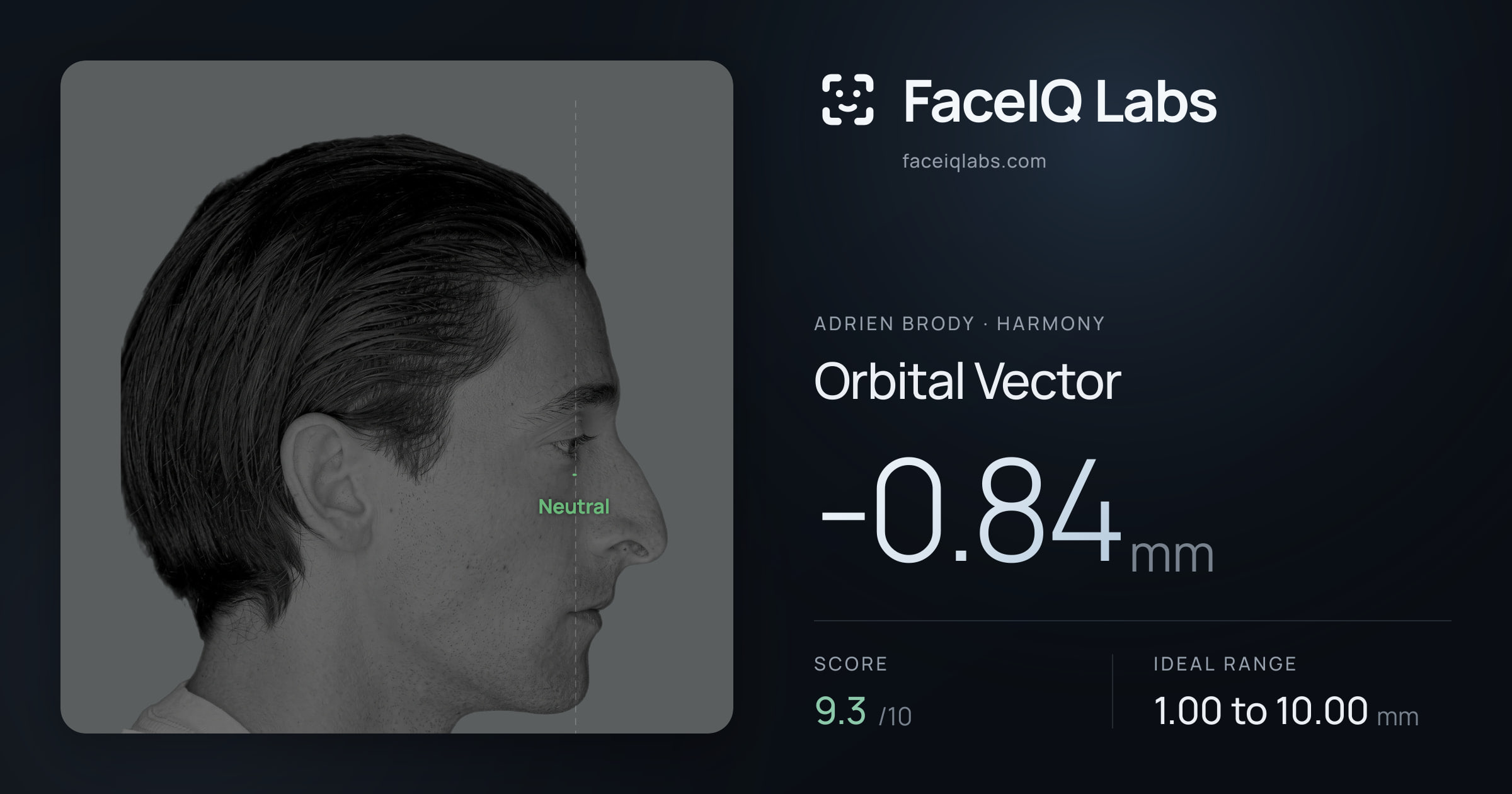 Adrien Brody Orbital Vector: -0.84mm, drawn on the photo