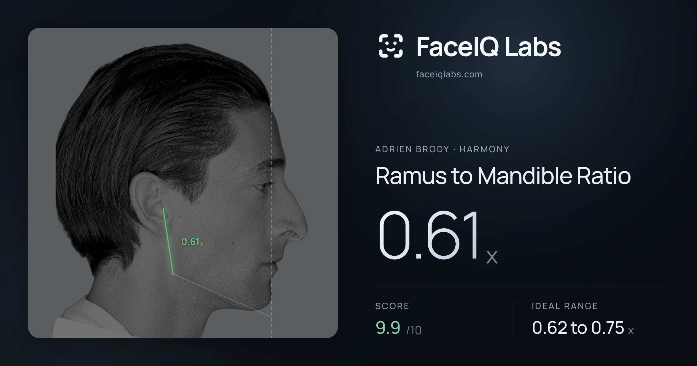 Adrien Brody Ramus to Mandible Ratio: 0.61x, drawn on the photo