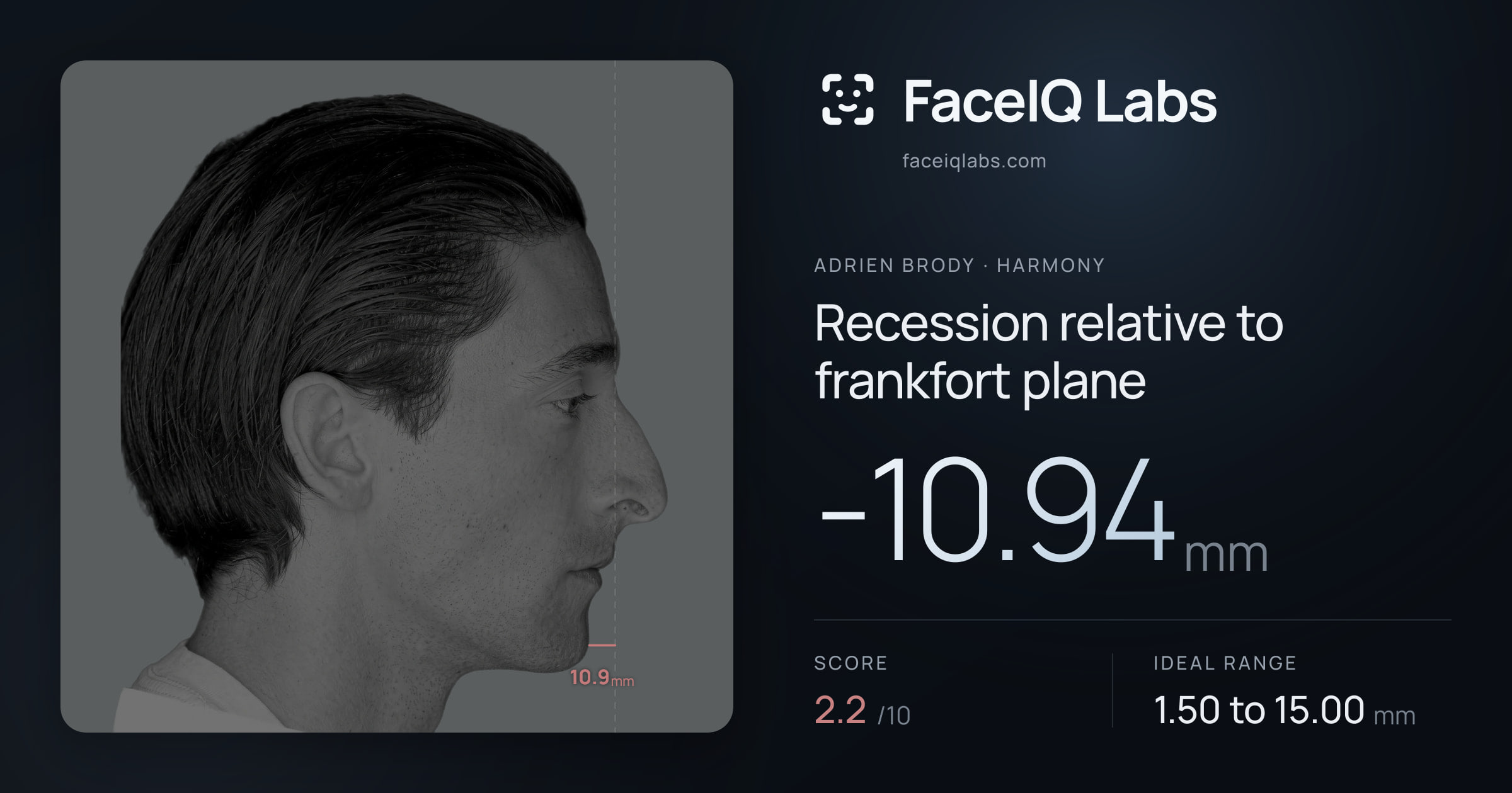 Adrien Brody Recession relative to frankfort plane: -10.94mm, drawn on the photo