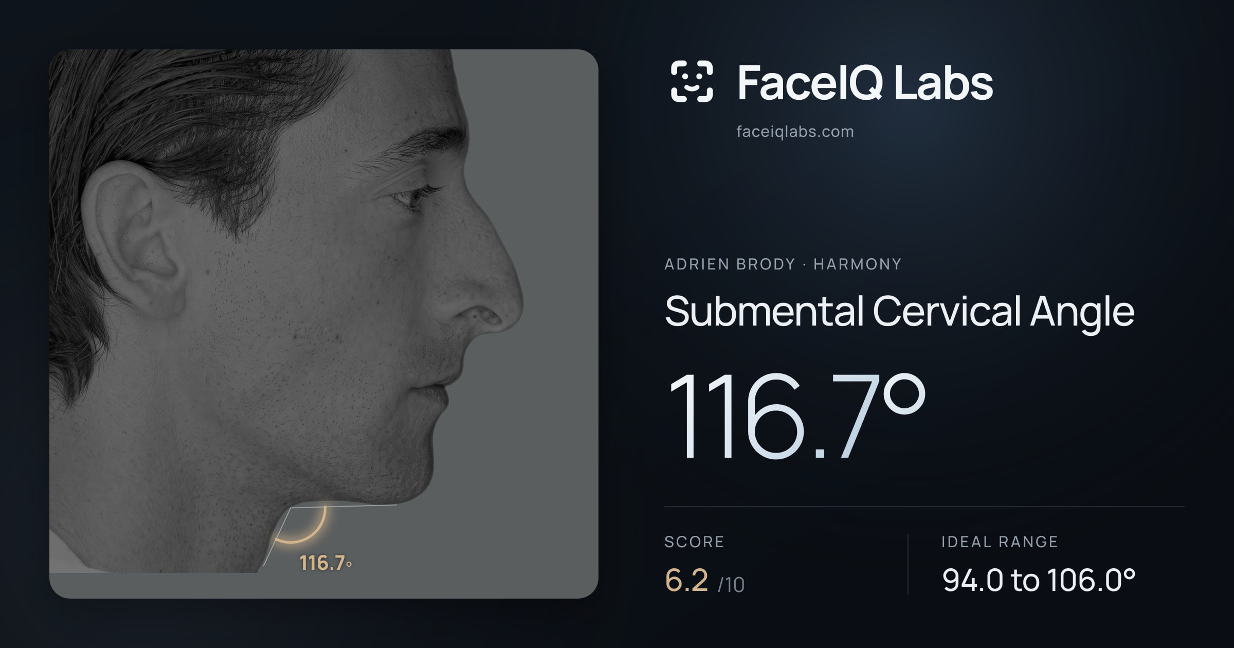 Adrien Brody Submental Cervical Angle: 116.7°, drawn on the photo