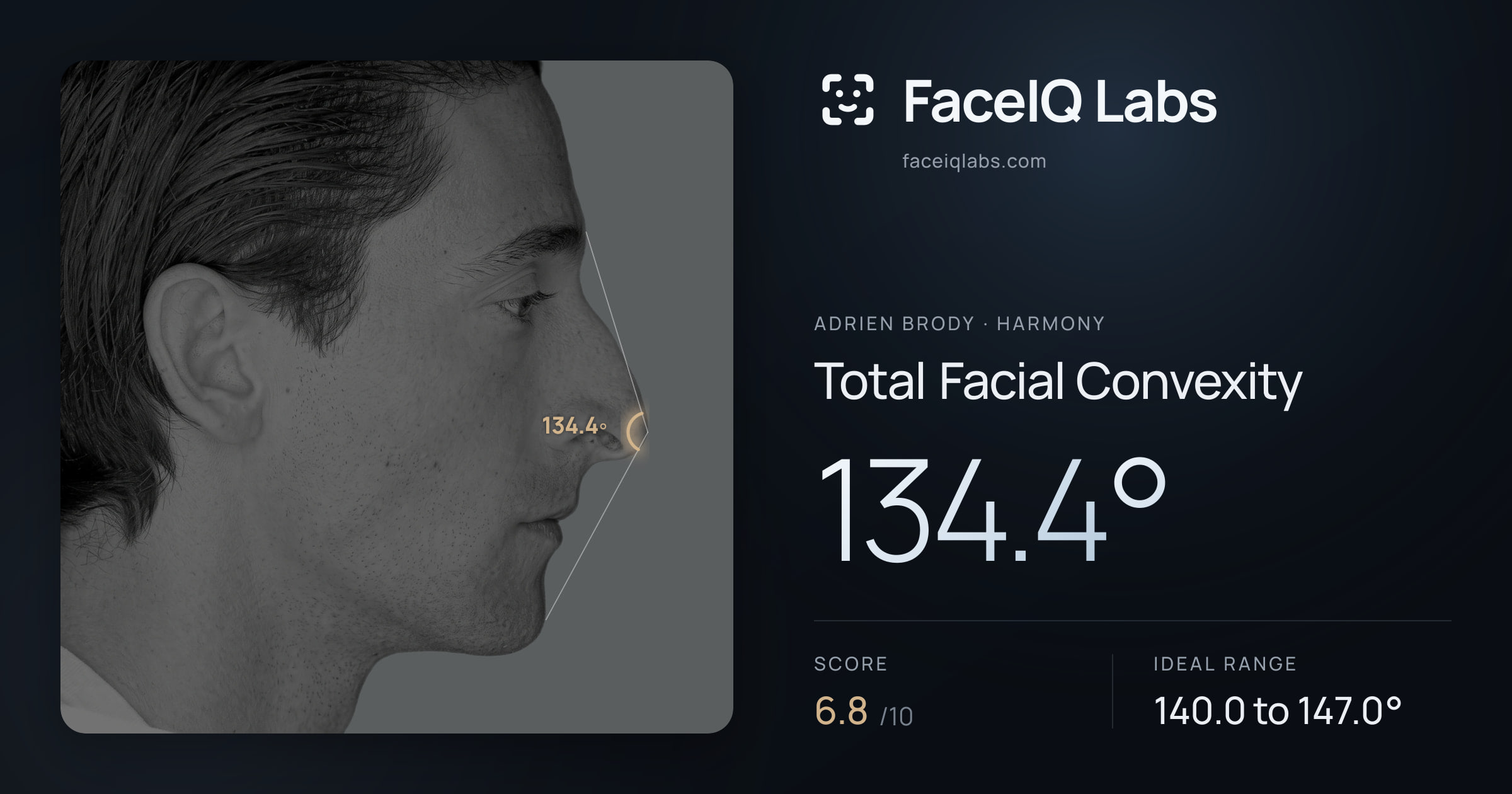 Adrien Brody Total Facial Convexity: 134.4°, drawn on the photo