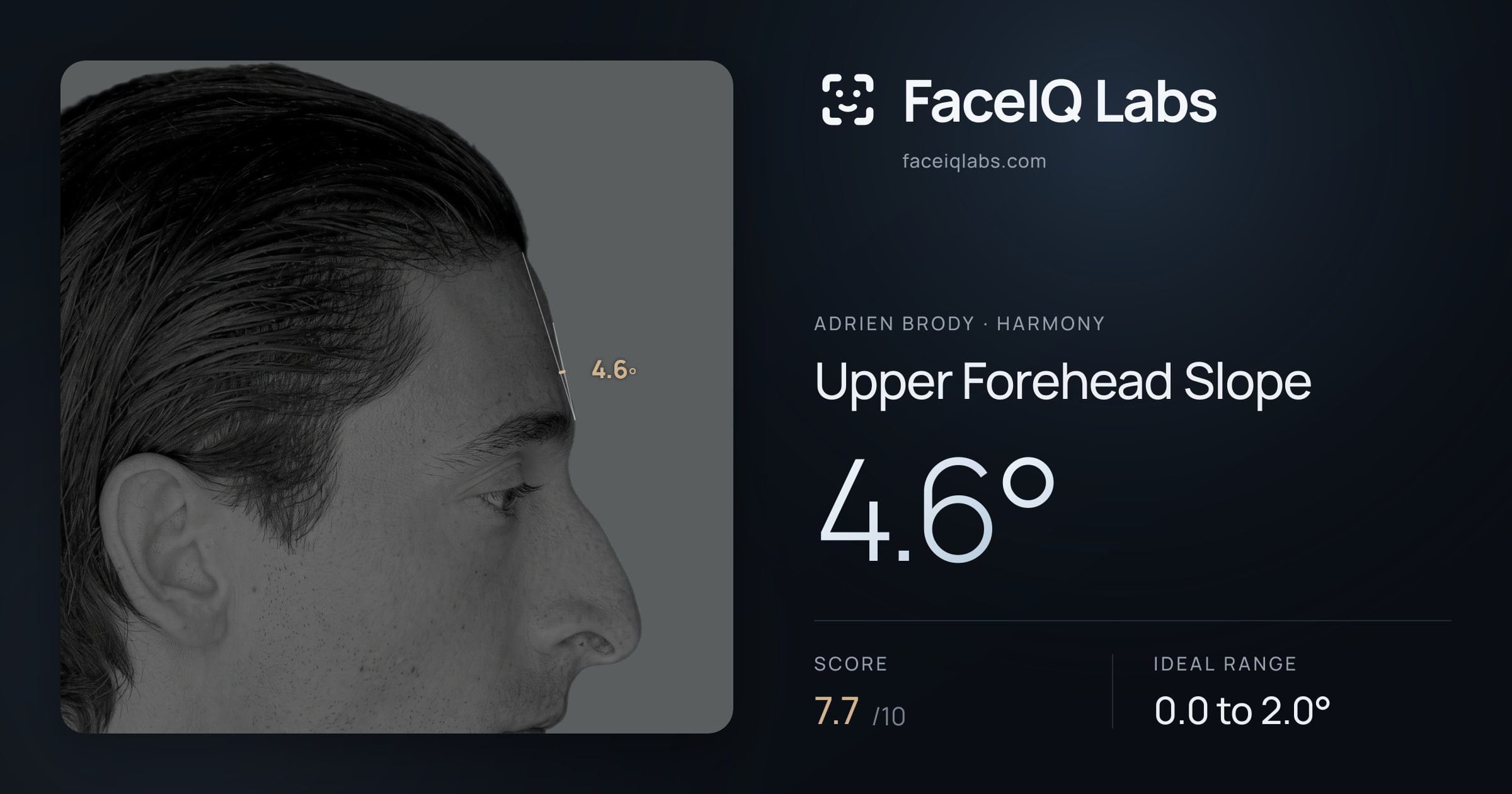 Adrien Brody Upper Forehead Slope: 4.6°, drawn on the photo