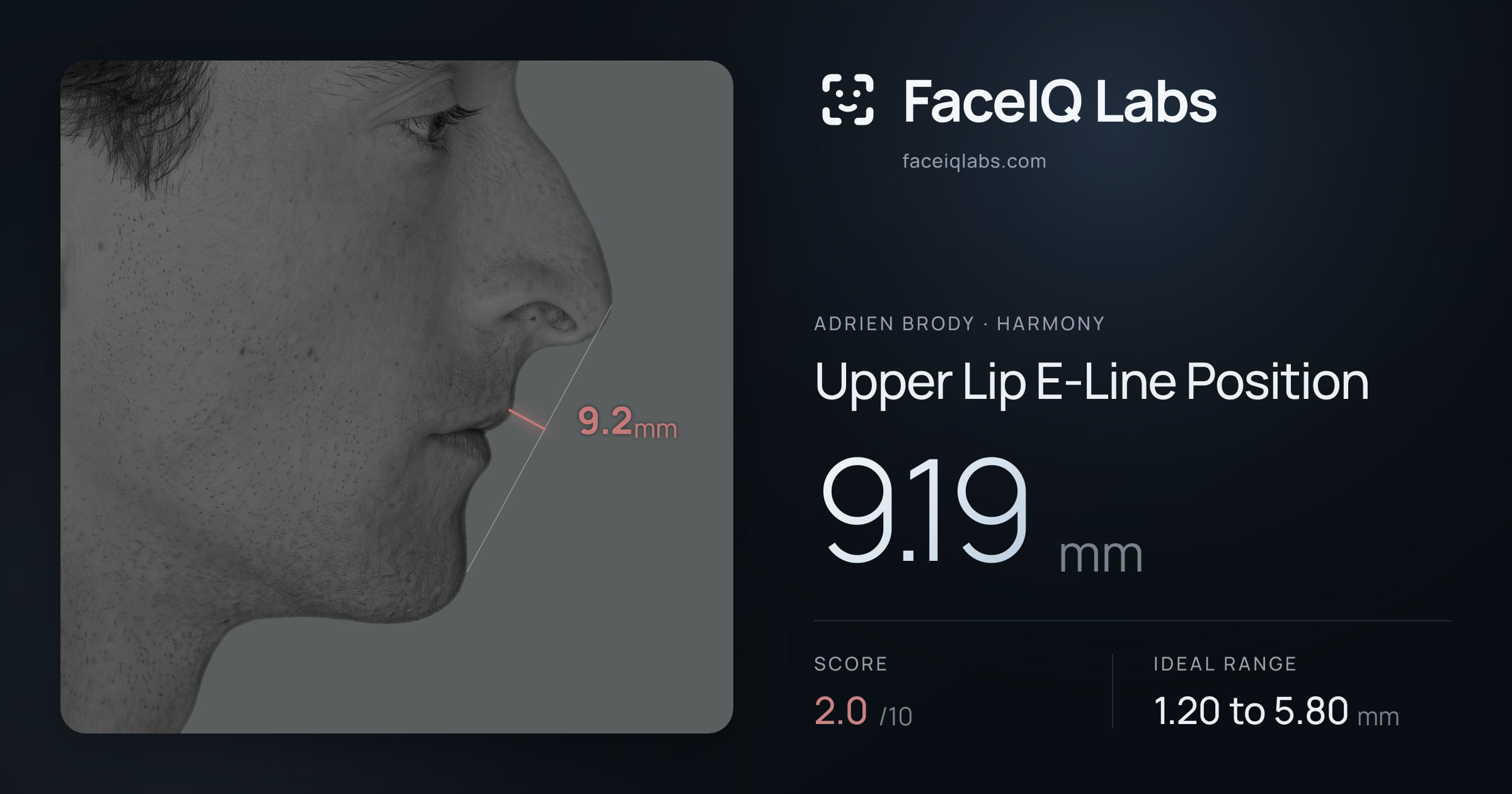 Adrien Brody Upper Lip E-Line Position: 9.19mm, drawn on the photo