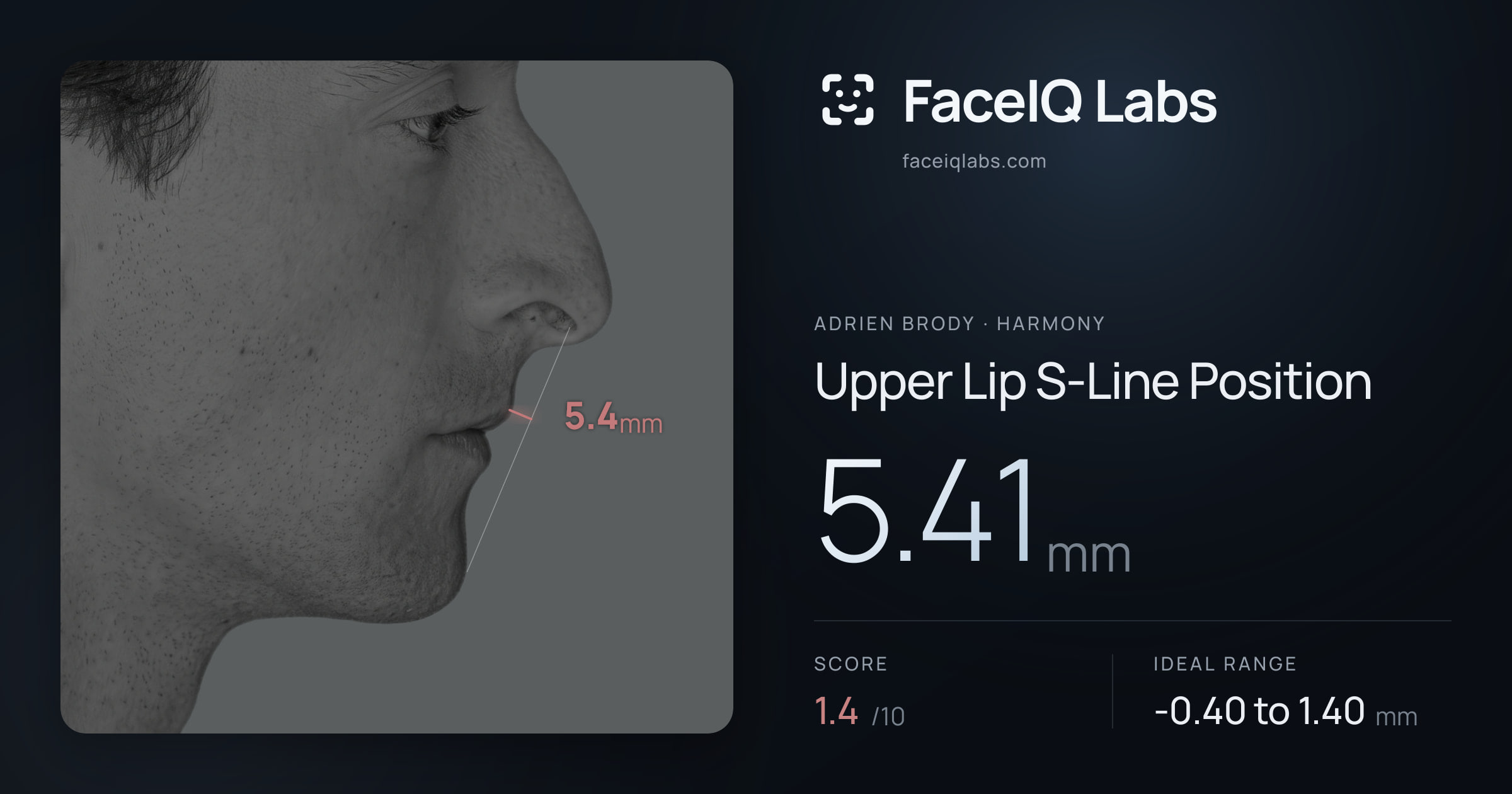 Adrien Brody Upper Lip S-Line Position: 5.41mm, drawn on the photo
