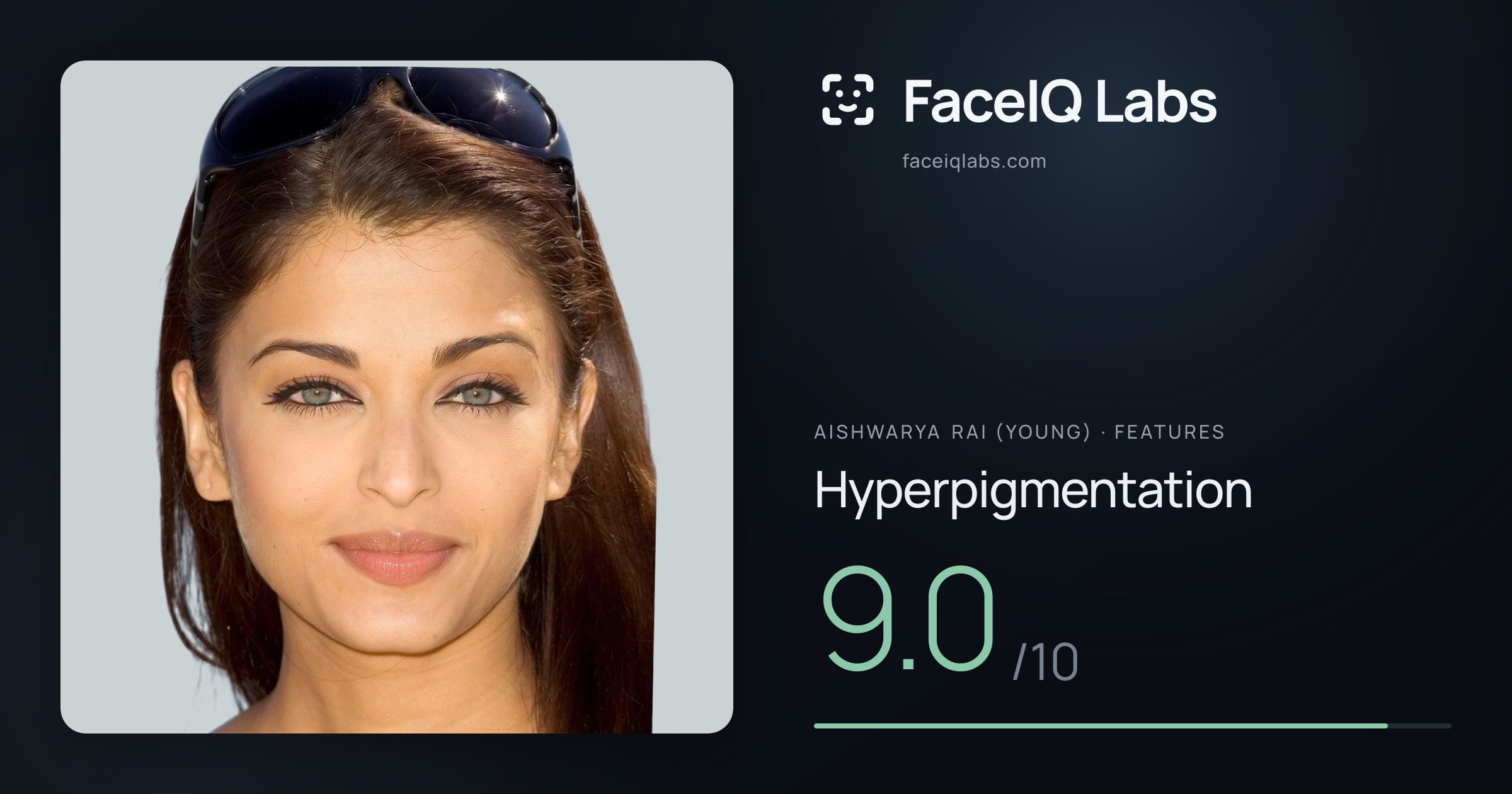 Aishwarya Rai (Young) Hyperpigmentation: 9.0/10, drawn on the photo