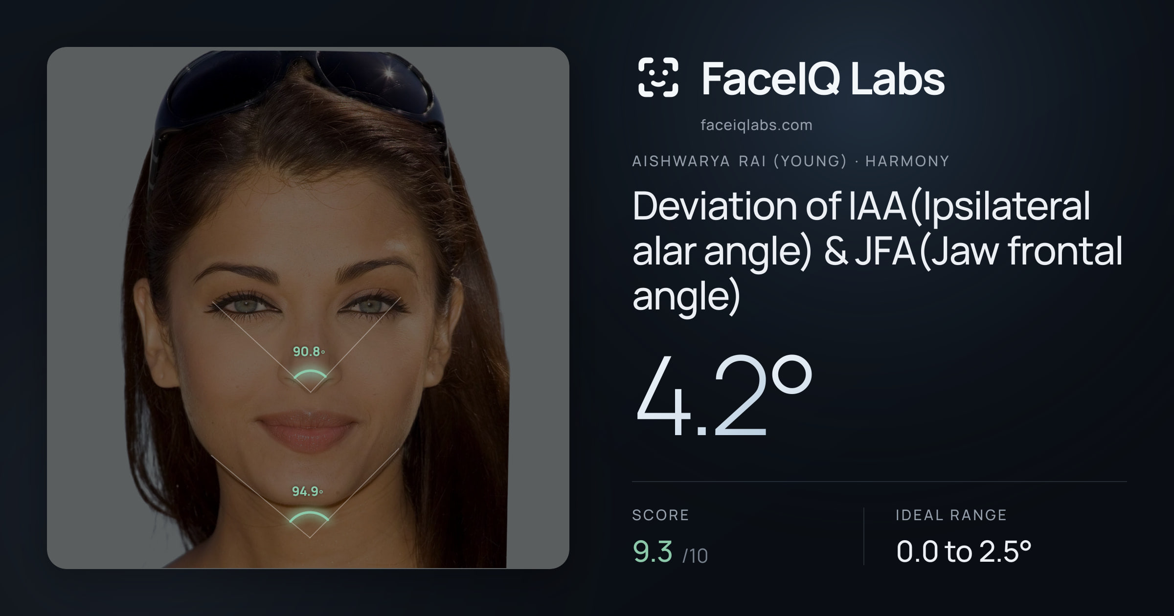 Aishwarya Rai (Young) Deviation of IAA(Ipsilateral alar angle) & JFA(Jaw frontal angle): 4.2°, drawn on the photo