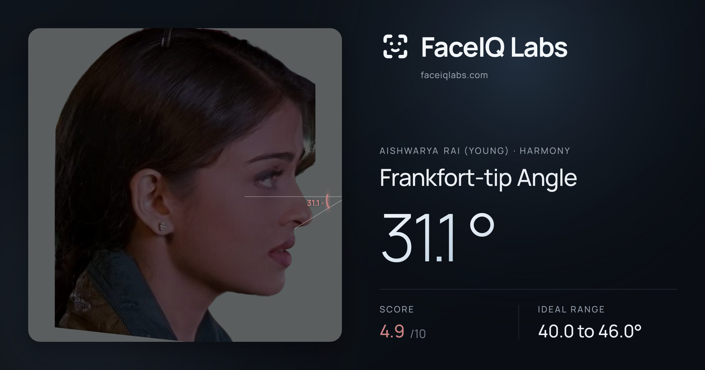 Aishwarya Rai (Young) Frankfort-tip Angle: 31.1°, drawn on the photo