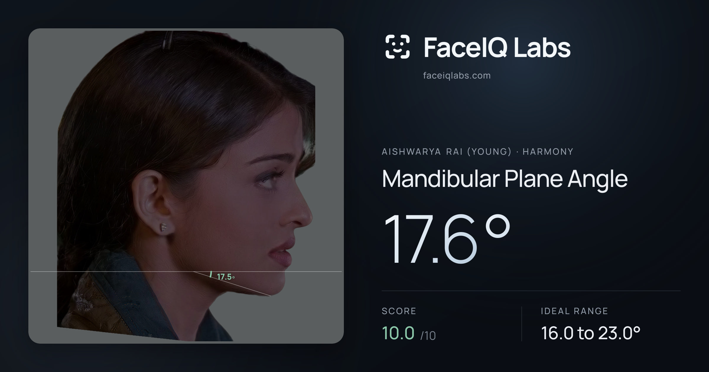 Aishwarya Rai (Young) Mandibular Plane Angle: 17.6°, drawn on the photo