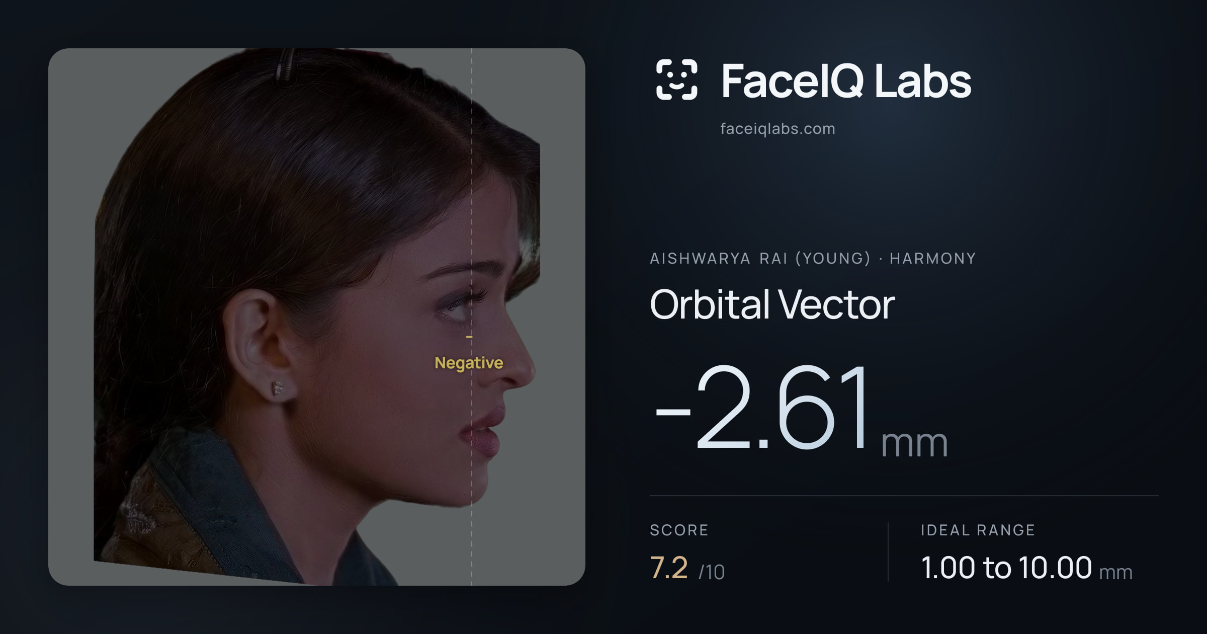Aishwarya Rai (Young) Orbital Vector: -2.61mm, drawn on the photo