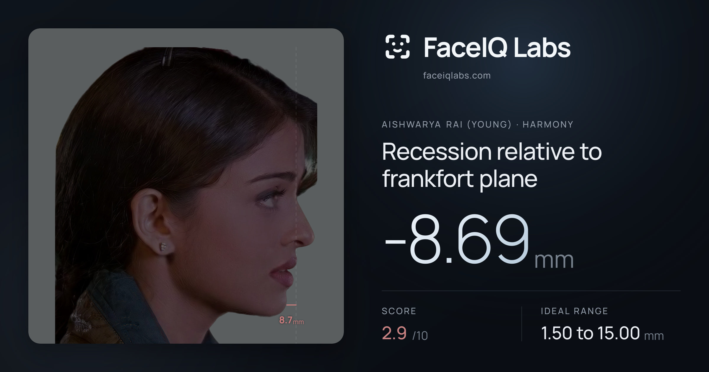 Aishwarya Rai (Young) Recession relative to frankfort plane: -8.69mm, drawn on the photo