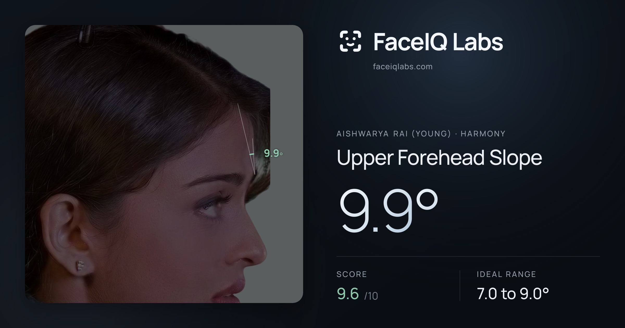 Aishwarya Rai (Young) Upper Forehead Slope: 9.9°, drawn on the photo
