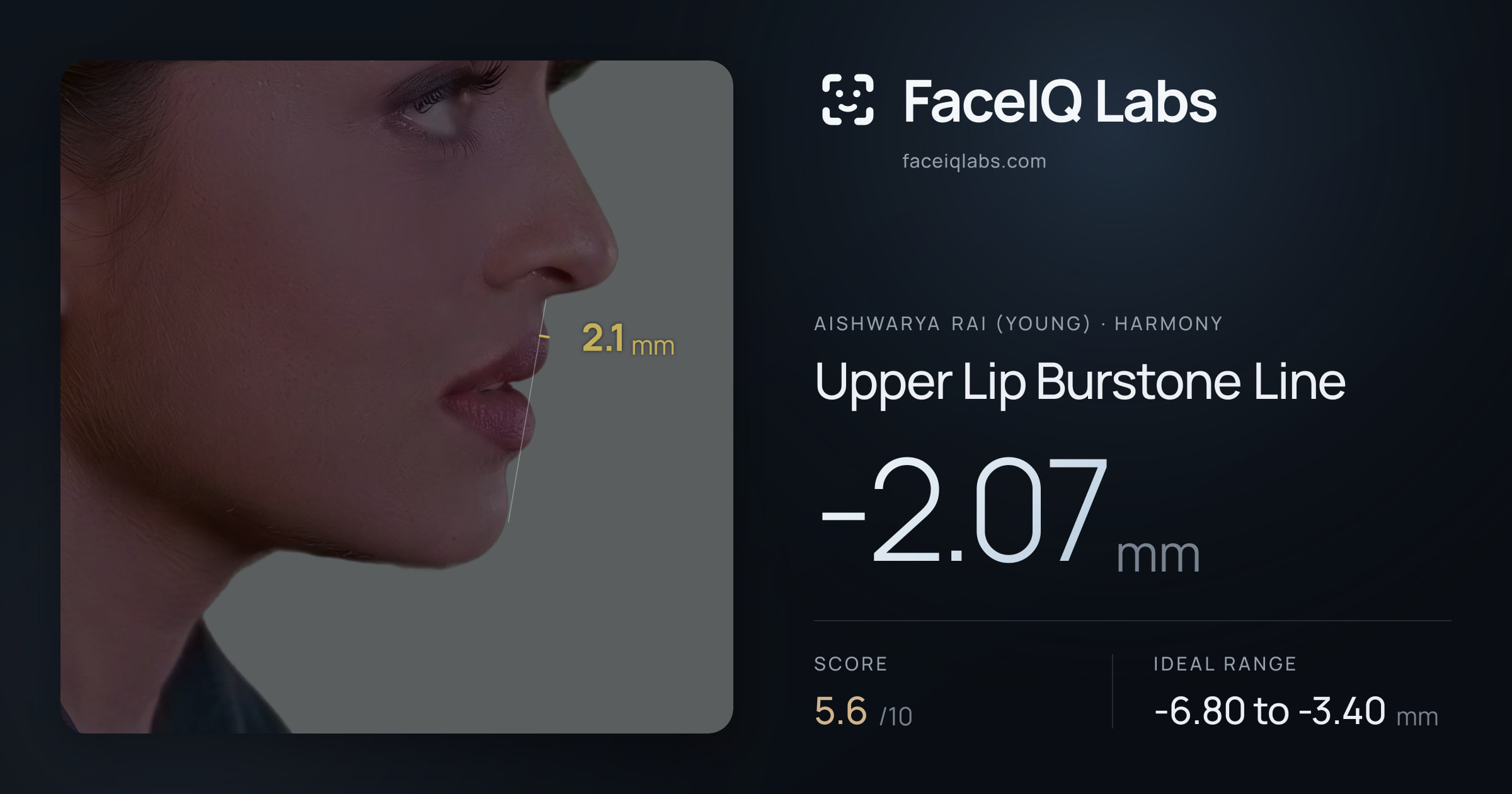 Aishwarya Rai (Young) Upper Lip Burstone Line: -2.07mm, drawn on the photo