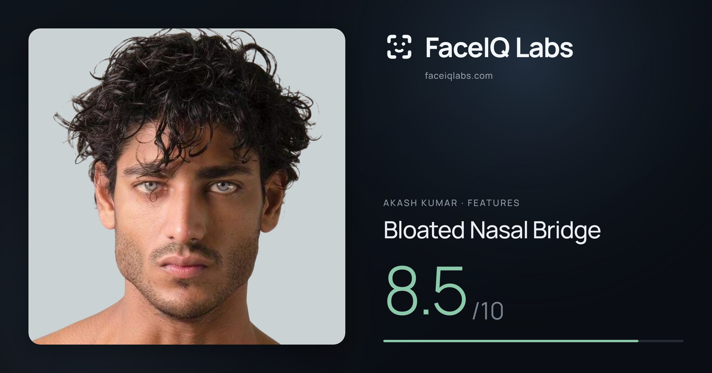 Akash Kumar Bloated Nasal Bridge: 8.5/10, drawn on the photo