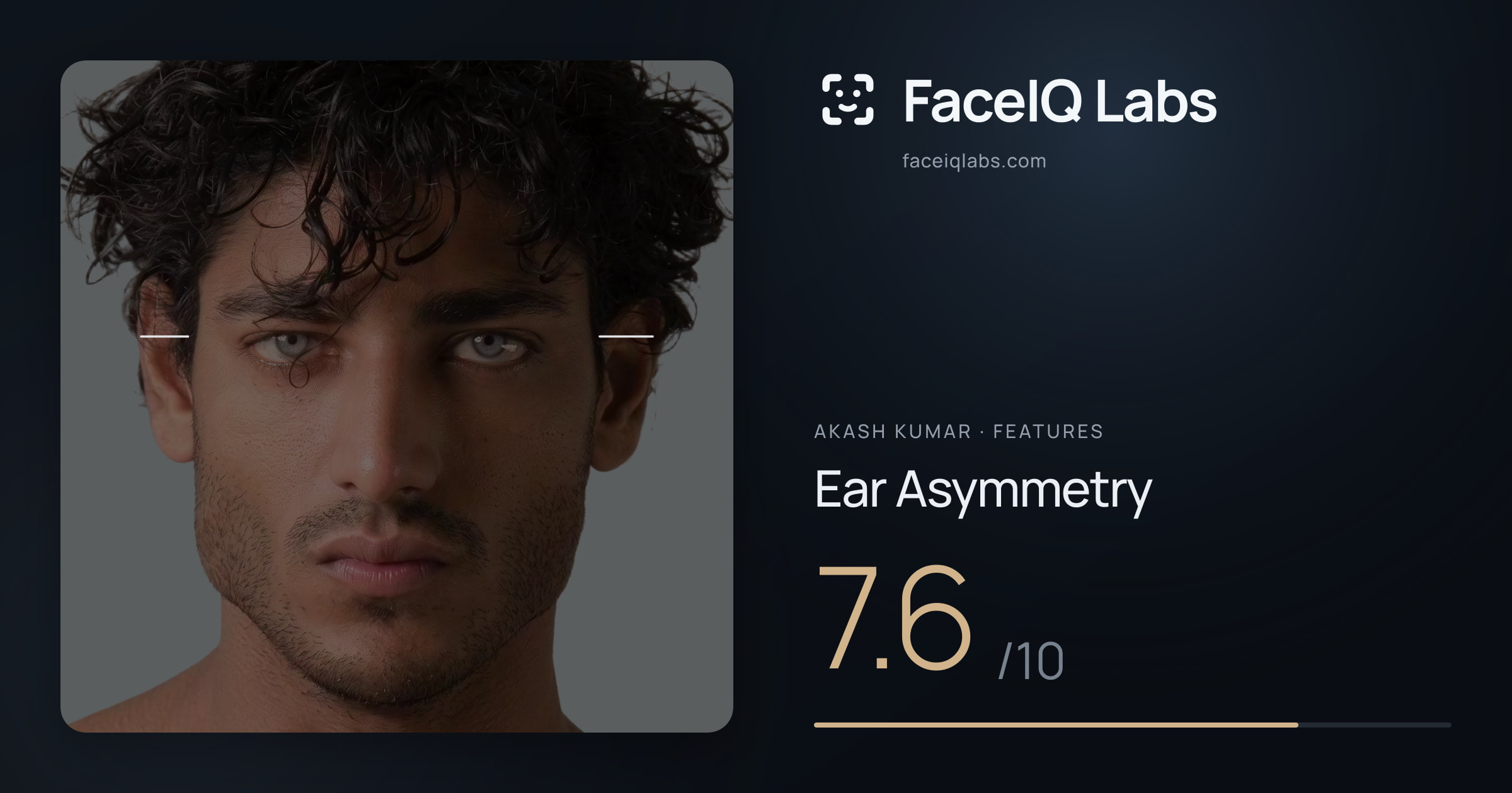 Akash Kumar Ear Asymmetry: 7.6/10, drawn on the photo