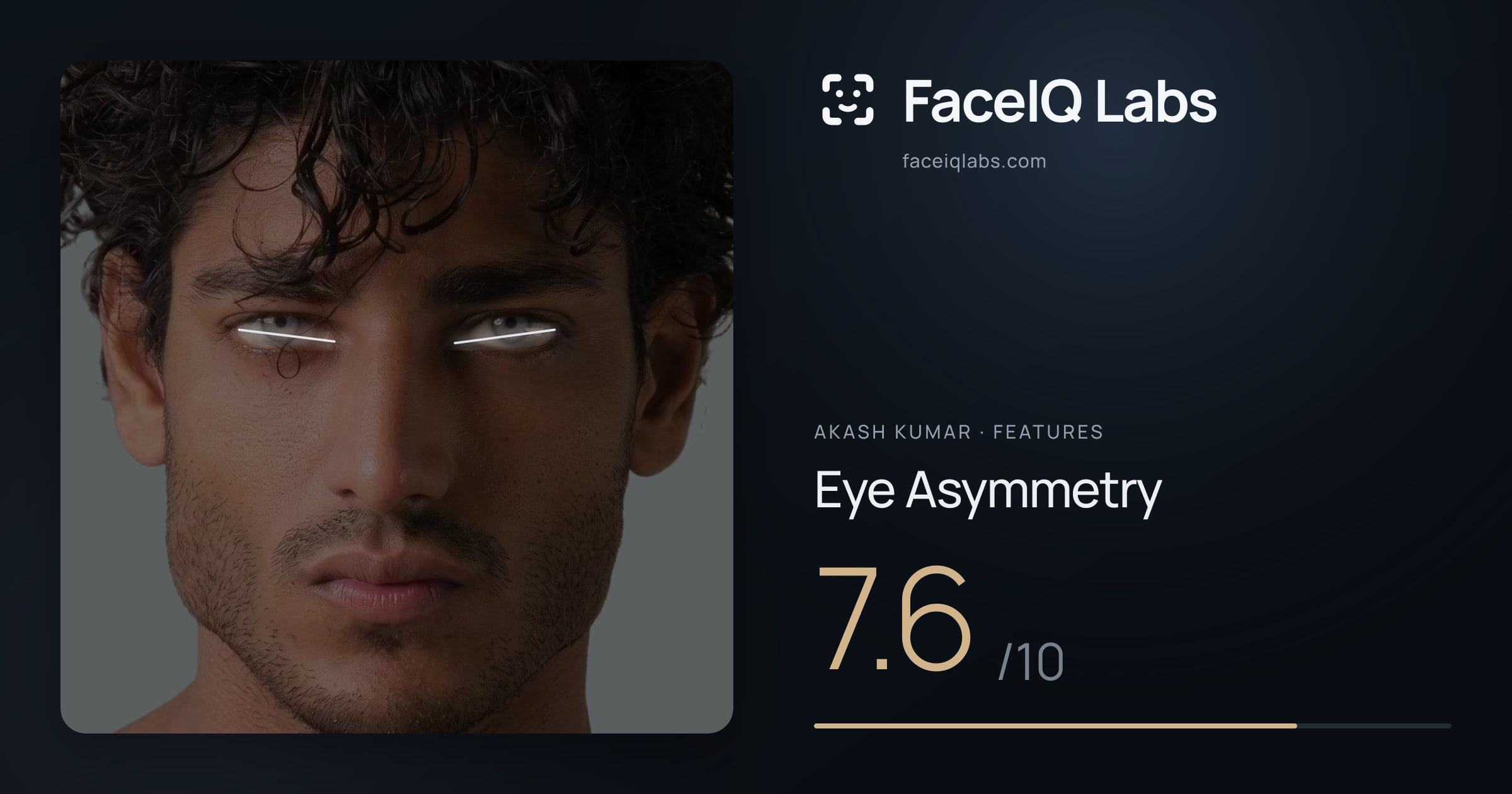 Akash Kumar Eye Asymmetry: 7.6/10, drawn on the photo