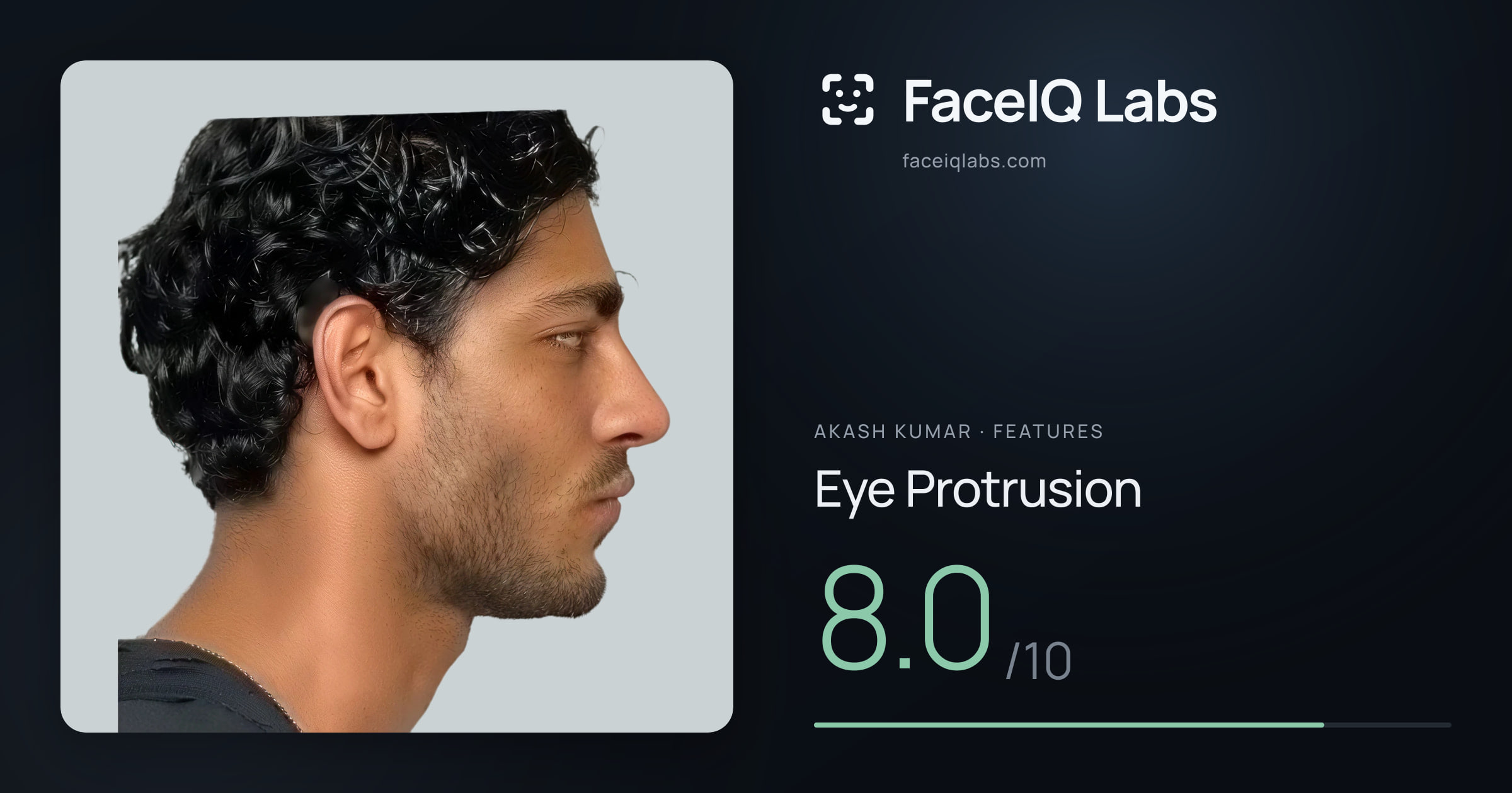 Akash Kumar Eye Protrusion: 8.0/10, drawn on the photo