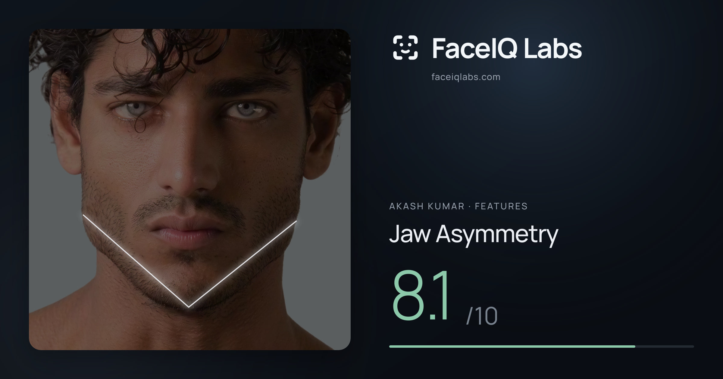 Akash Kumar Jaw Asymmetry: 8.1/10, drawn on the photo