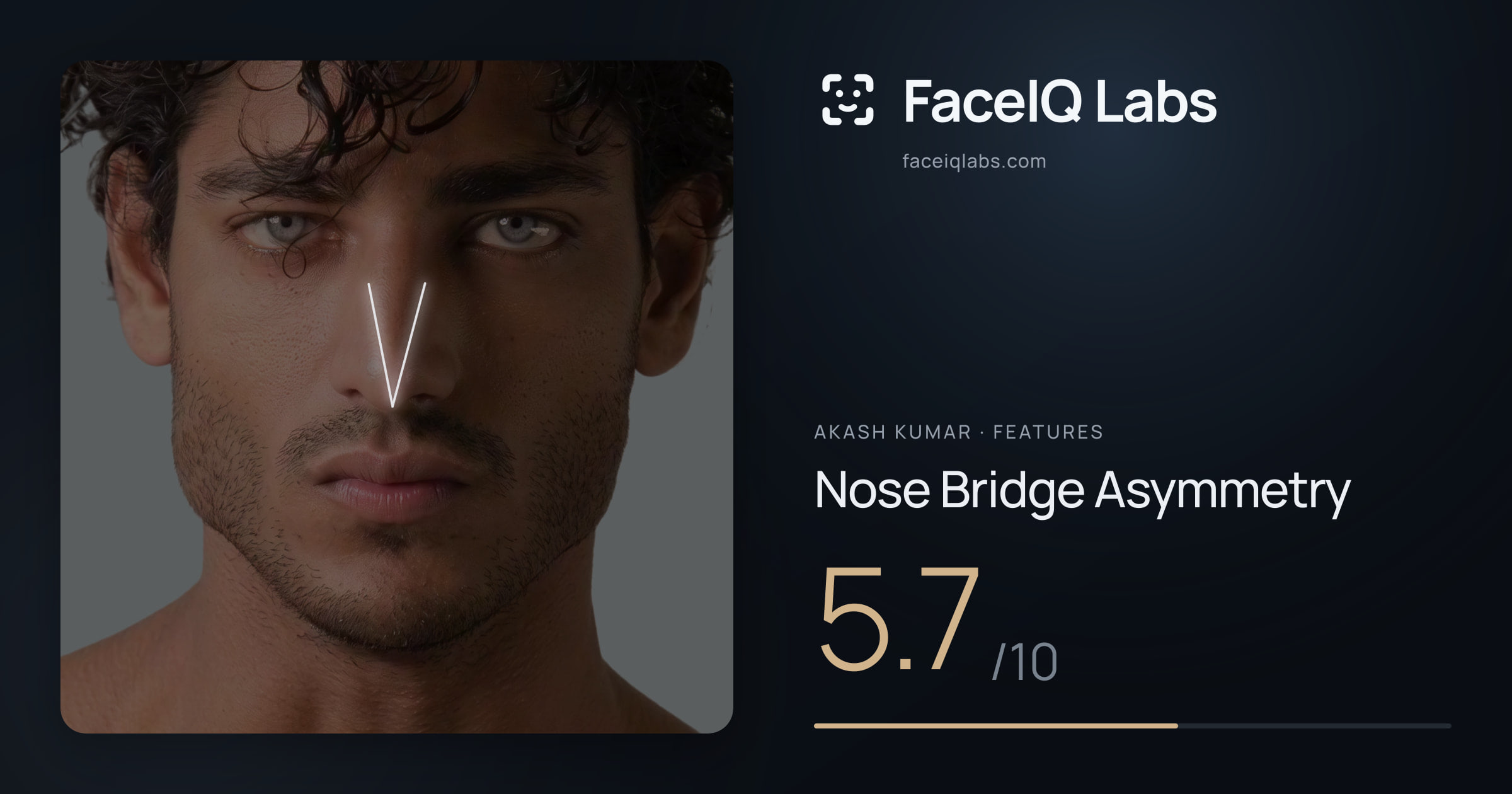 Akash Kumar Nose Bridge Asymmetry: 5.7/10, drawn on the photo