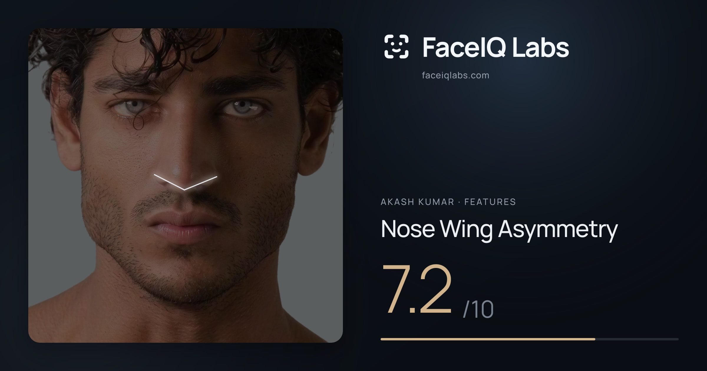Akash Kumar Nose Wing Asymmetry: 7.2/10, drawn on the photo