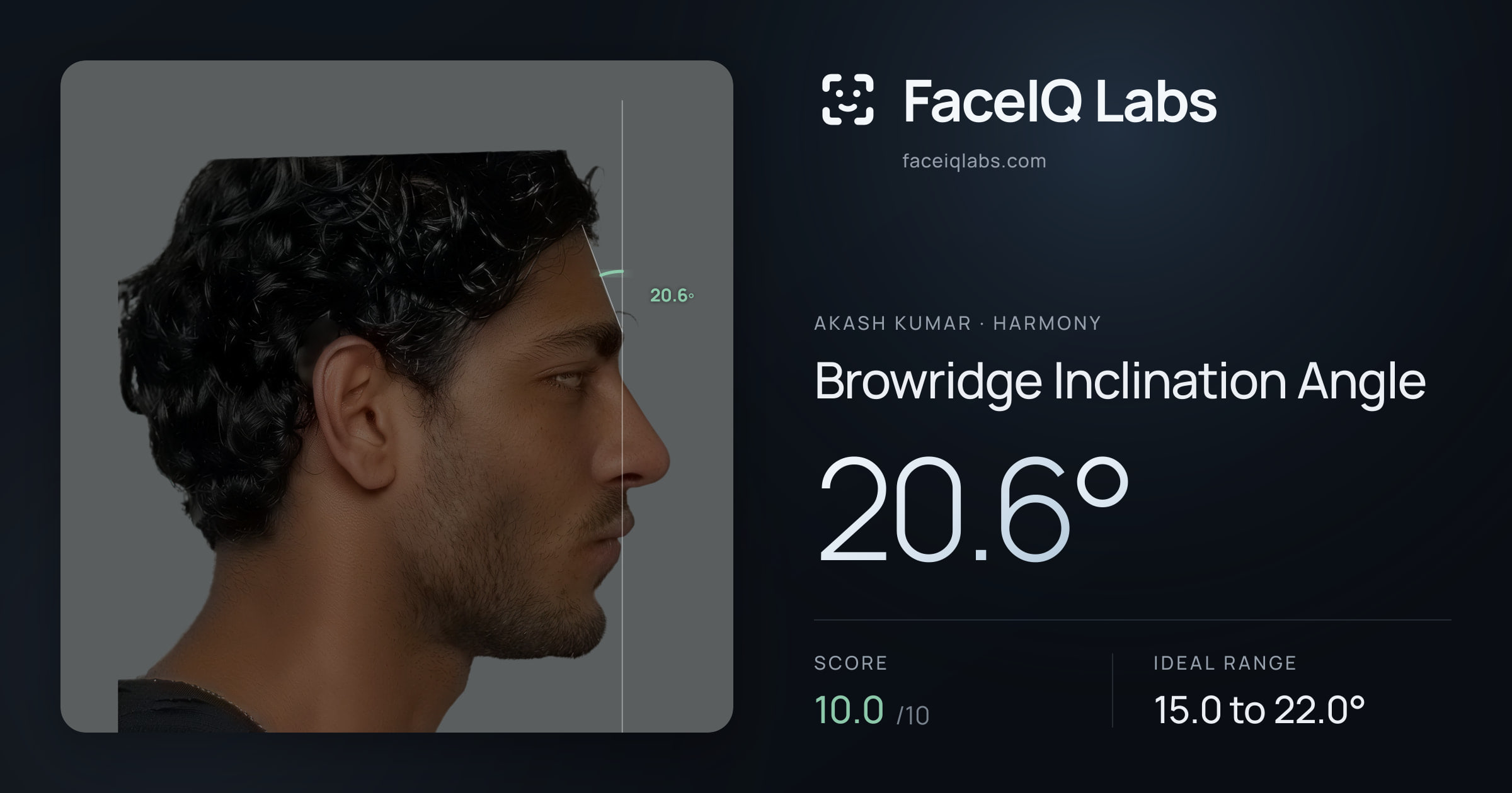 Akash Kumar Browridge Inclination Angle: 20.6°, drawn on the photo