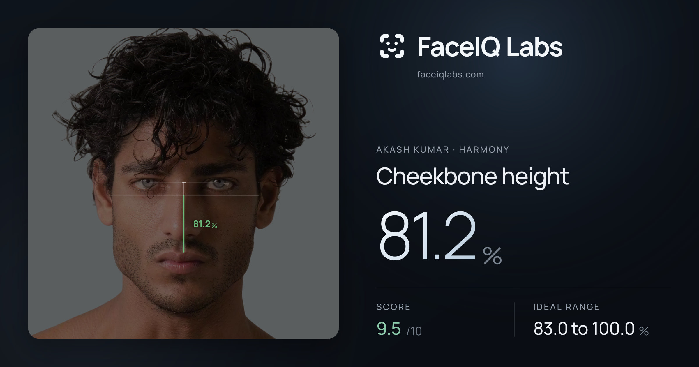 Akash Kumar Cheekbone height: 81.2%, drawn on the photo