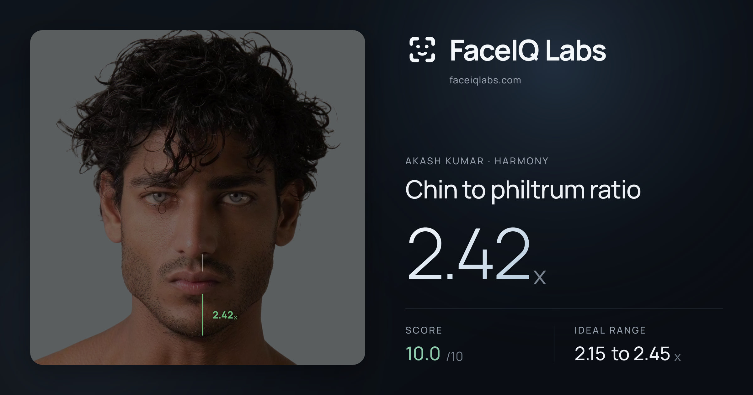 Akash Kumar Chin to philtrum ratio: 2.42x, drawn on the photo