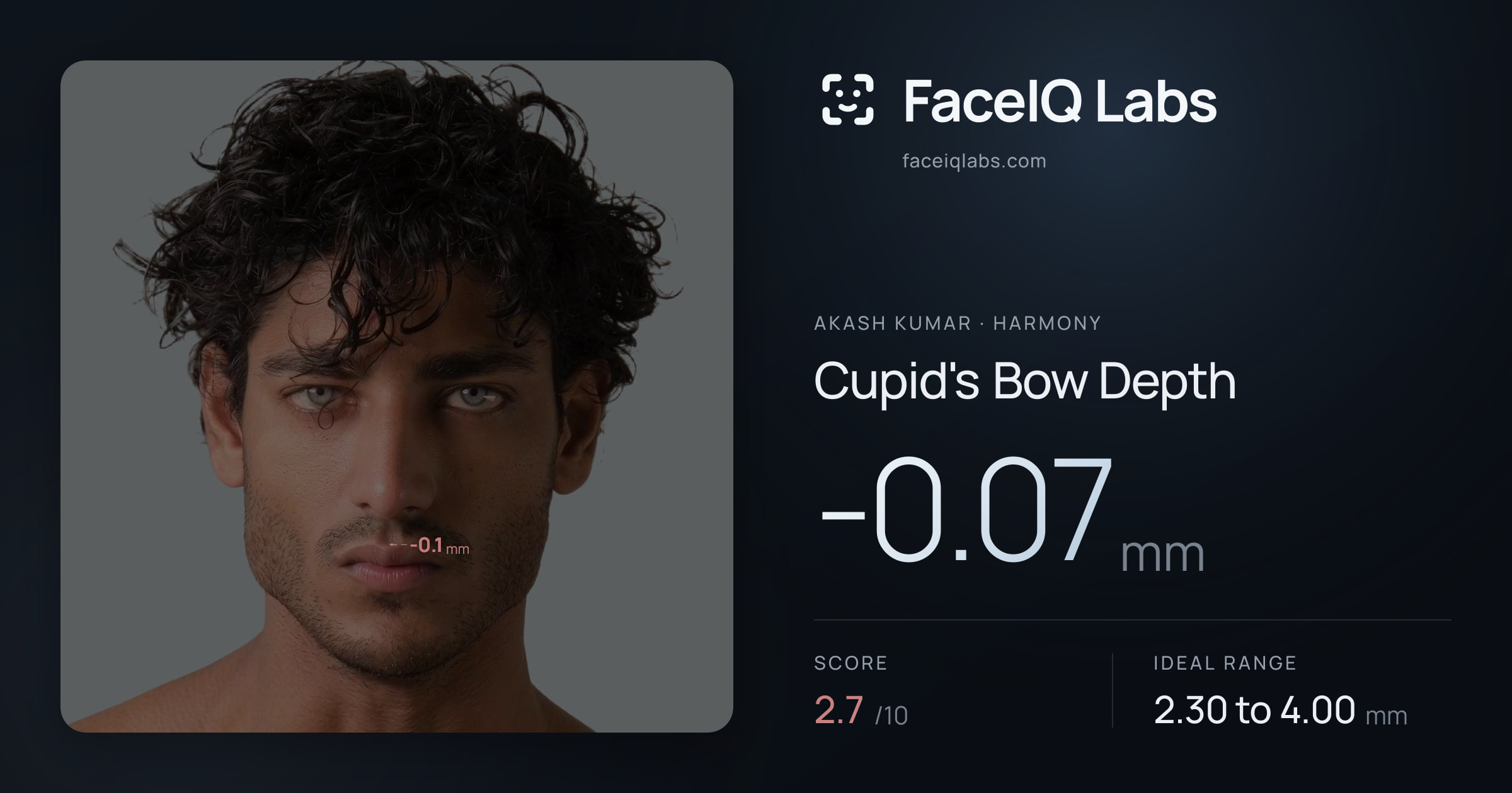 Akash Kumar Cupid's Bow Depth: -0.07mm, drawn on the photo