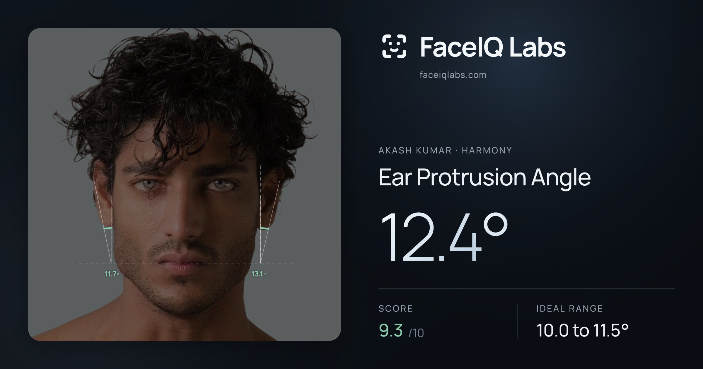 Akash Kumar Ear Protrusion Angle: 12.4°, drawn on the photo