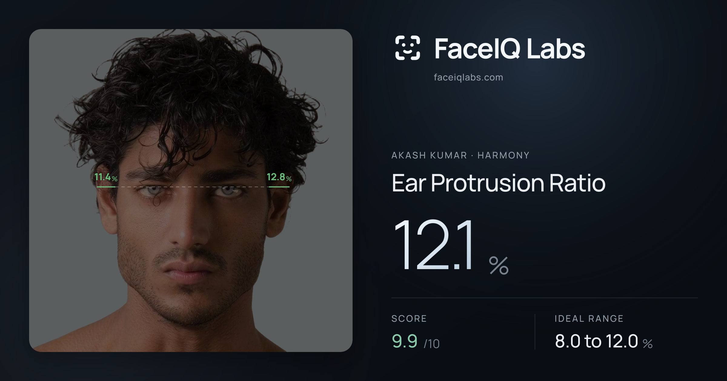 Akash Kumar Ear Protrusion Ratio: 12.1%, drawn on the photo