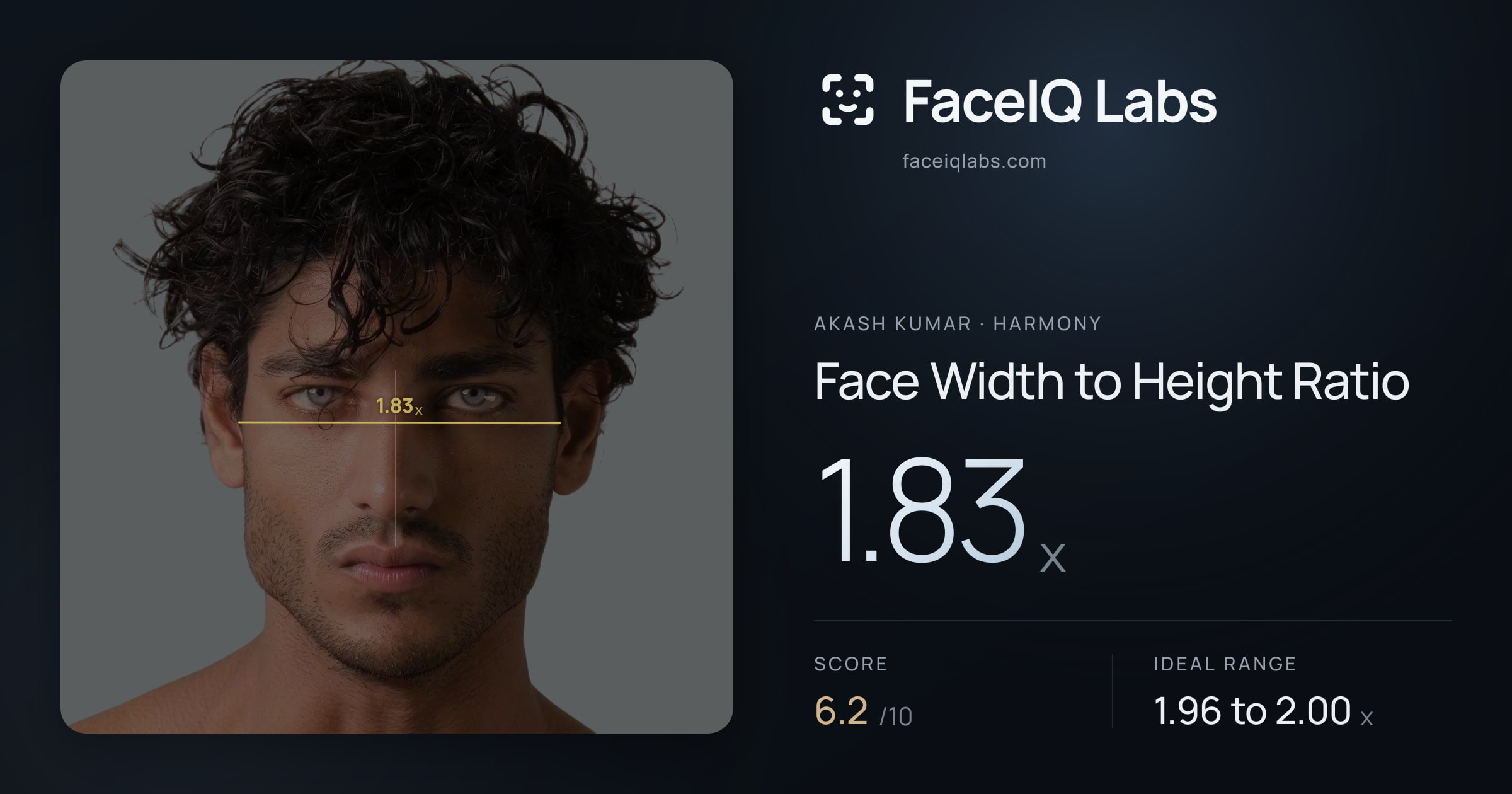 Akash Kumar Face Width to Height Ratio: 1.83x, drawn on the photo