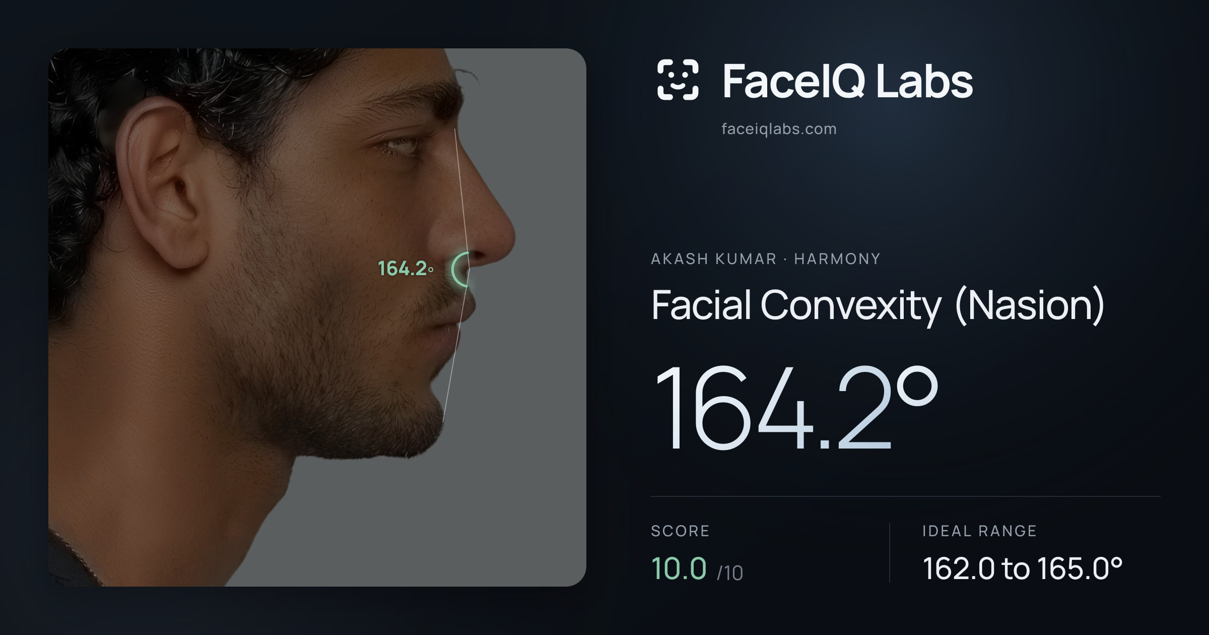 Akash Kumar Facial Convexity (Nasion): 164.2°, drawn on the photo
